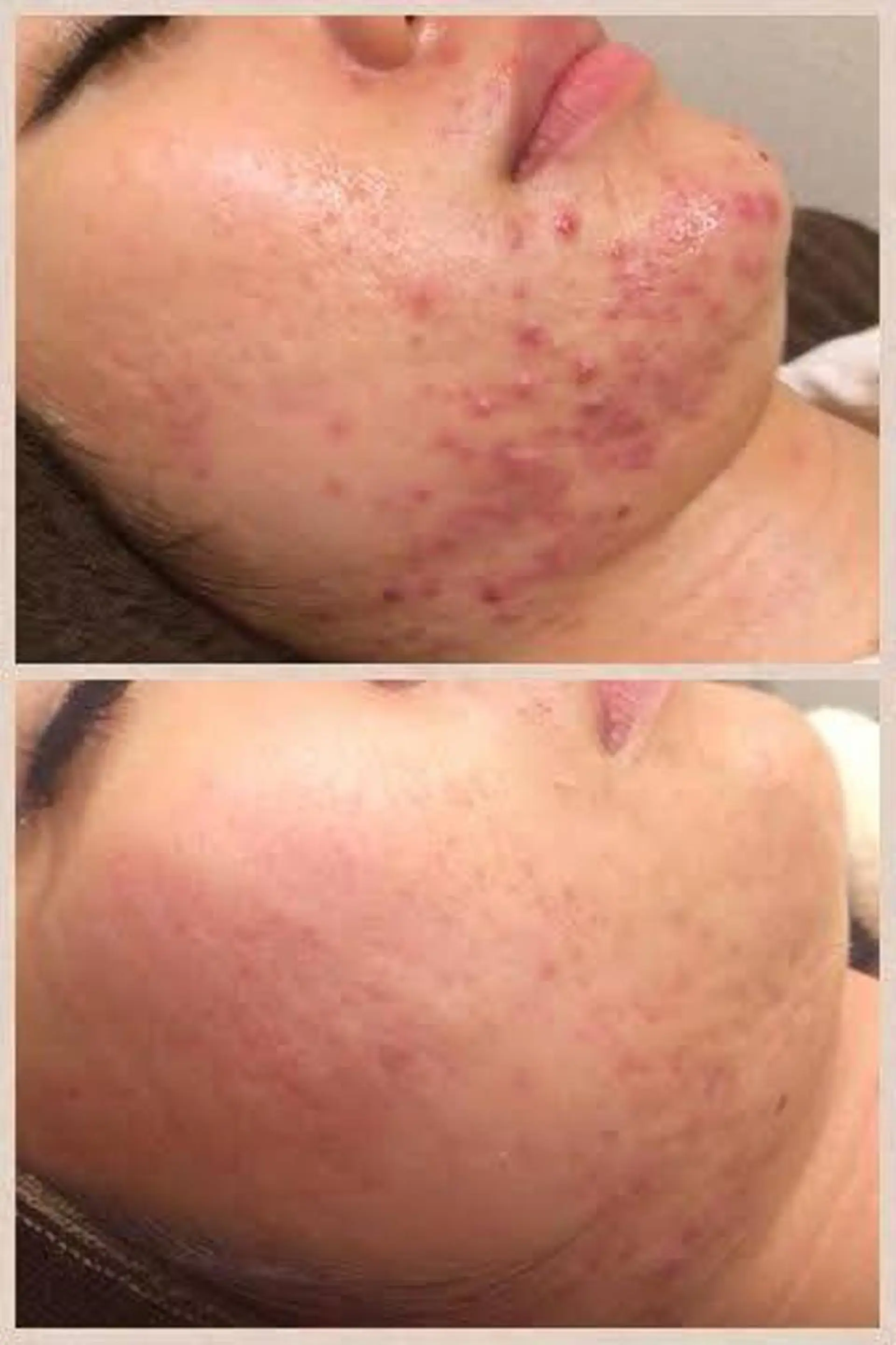 エステ まつげ/整体/にきび ・アトピー専門サロンのマツエク・マツパデザイン