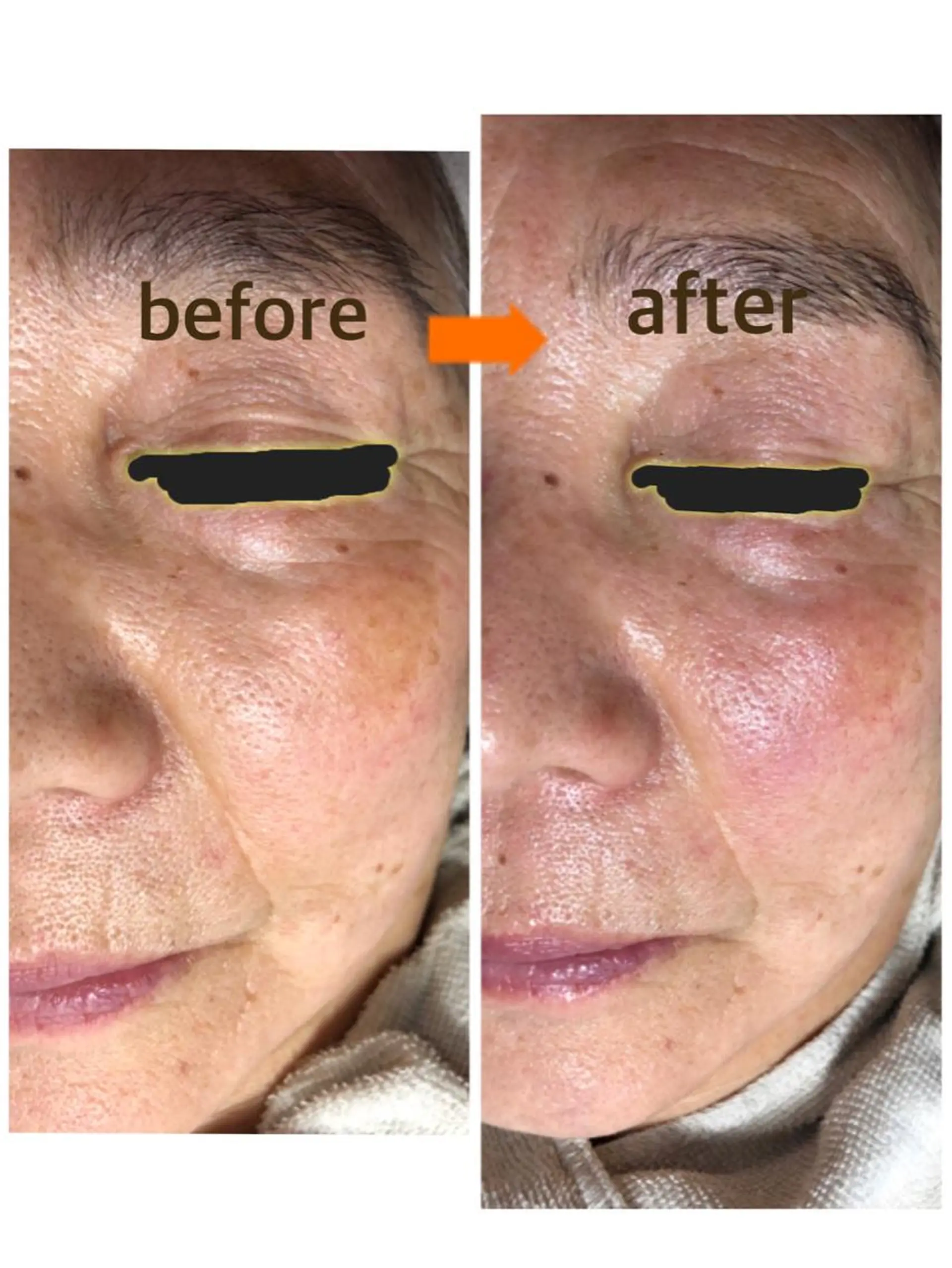 小顔・毛穴・たるみ ネイル　似内真樹のエステ・リラクイメージ