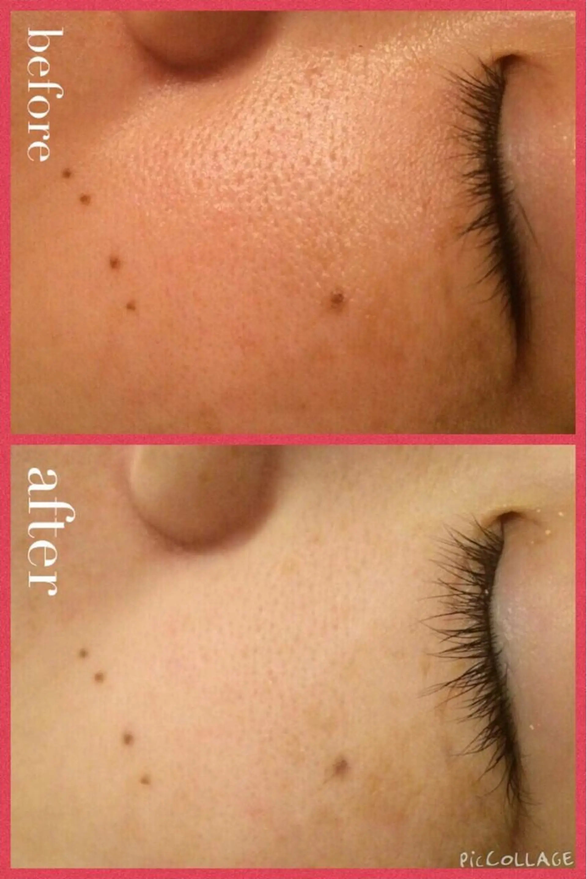 メンズ 金の糸脱毛 産毛ケア専門のエステ・リラクイメージ