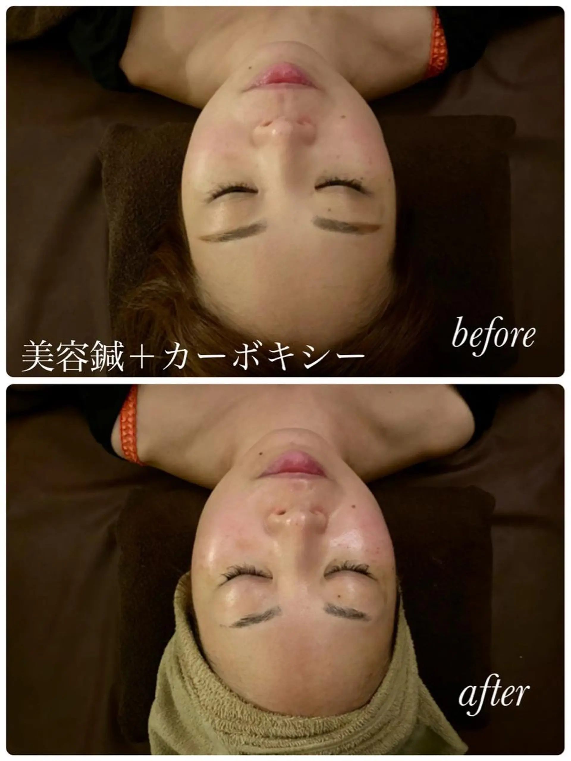 美容鍼灸サロン YOSHINOのエステ・リラクイメージ