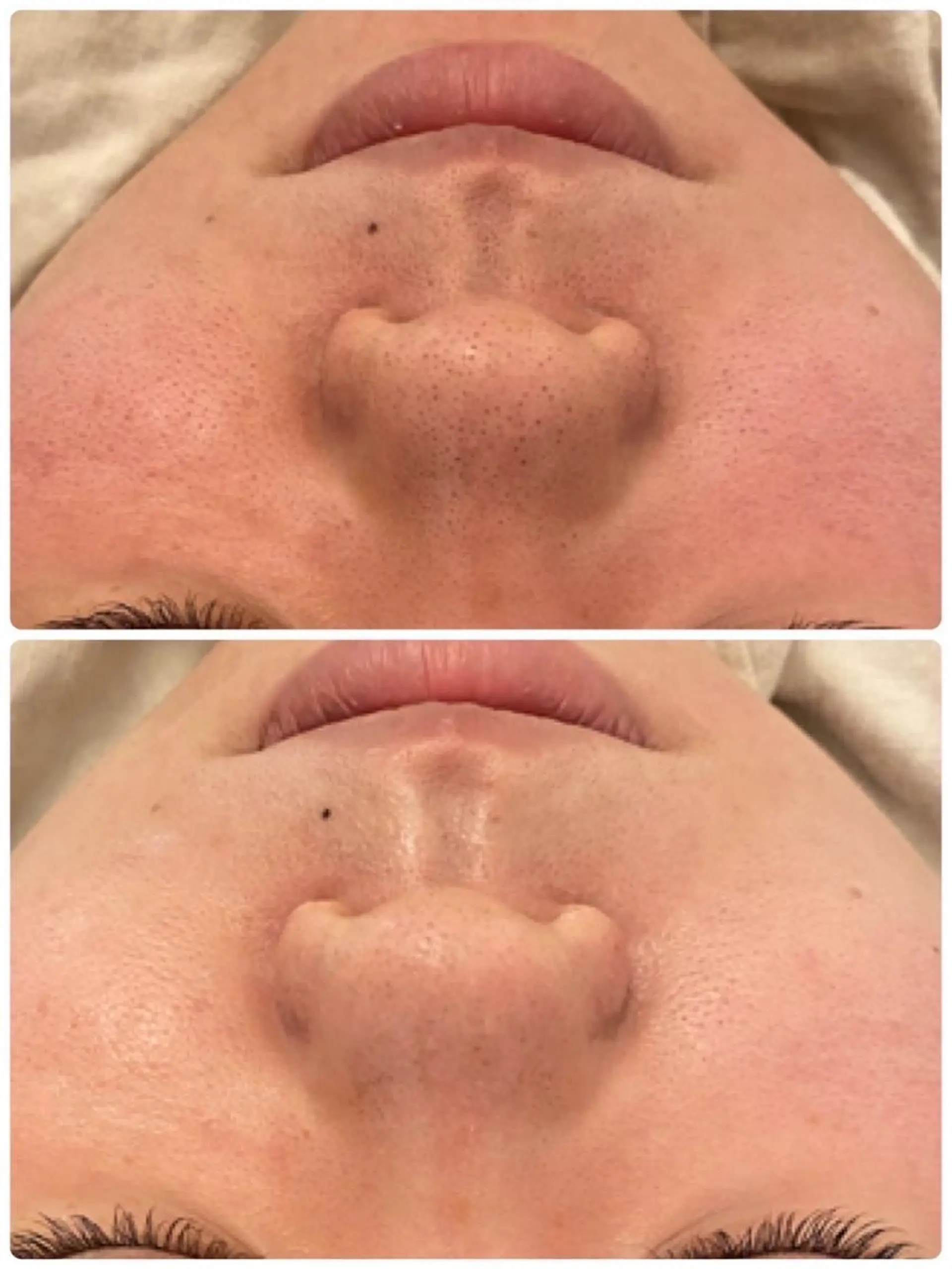 ララ/ハーブ メゾンリュバンのエステ・リラクイメージ