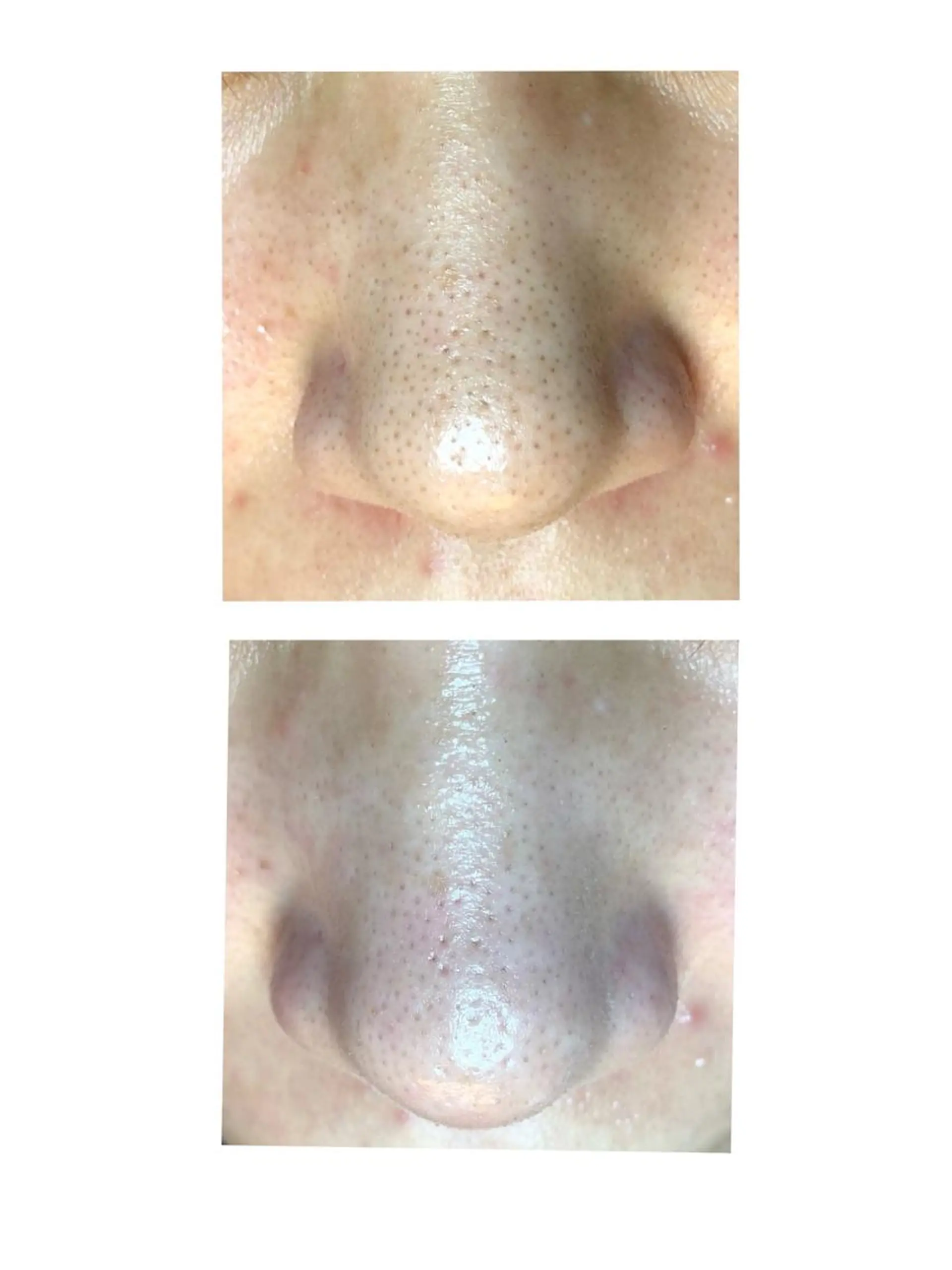 リフュージュ隠れ家 八王子の眉毛・アイブロウイメージ