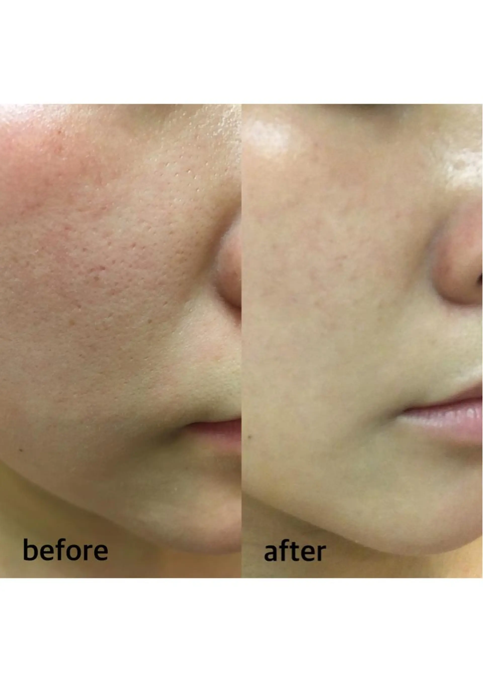 全身脱毛/韓国ツヤ肌 ハーブピーリングのエステ・リラクイメージ