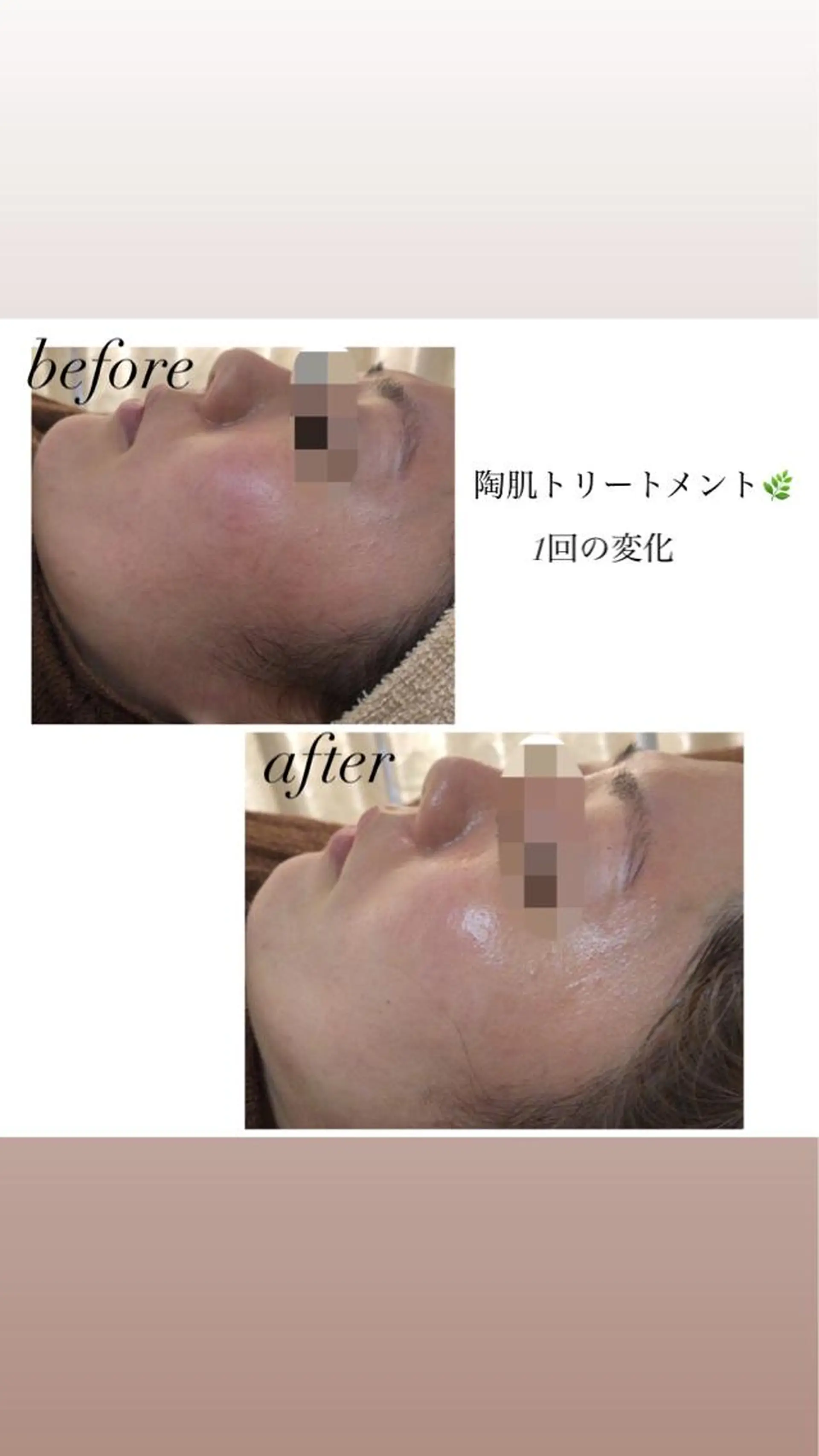 ミディアム カラー パーマ ヘアアレンジ メンズ キッズ ネイル マツエク・マツパ Amaryllis 🌹のエステ・リラクイメージ