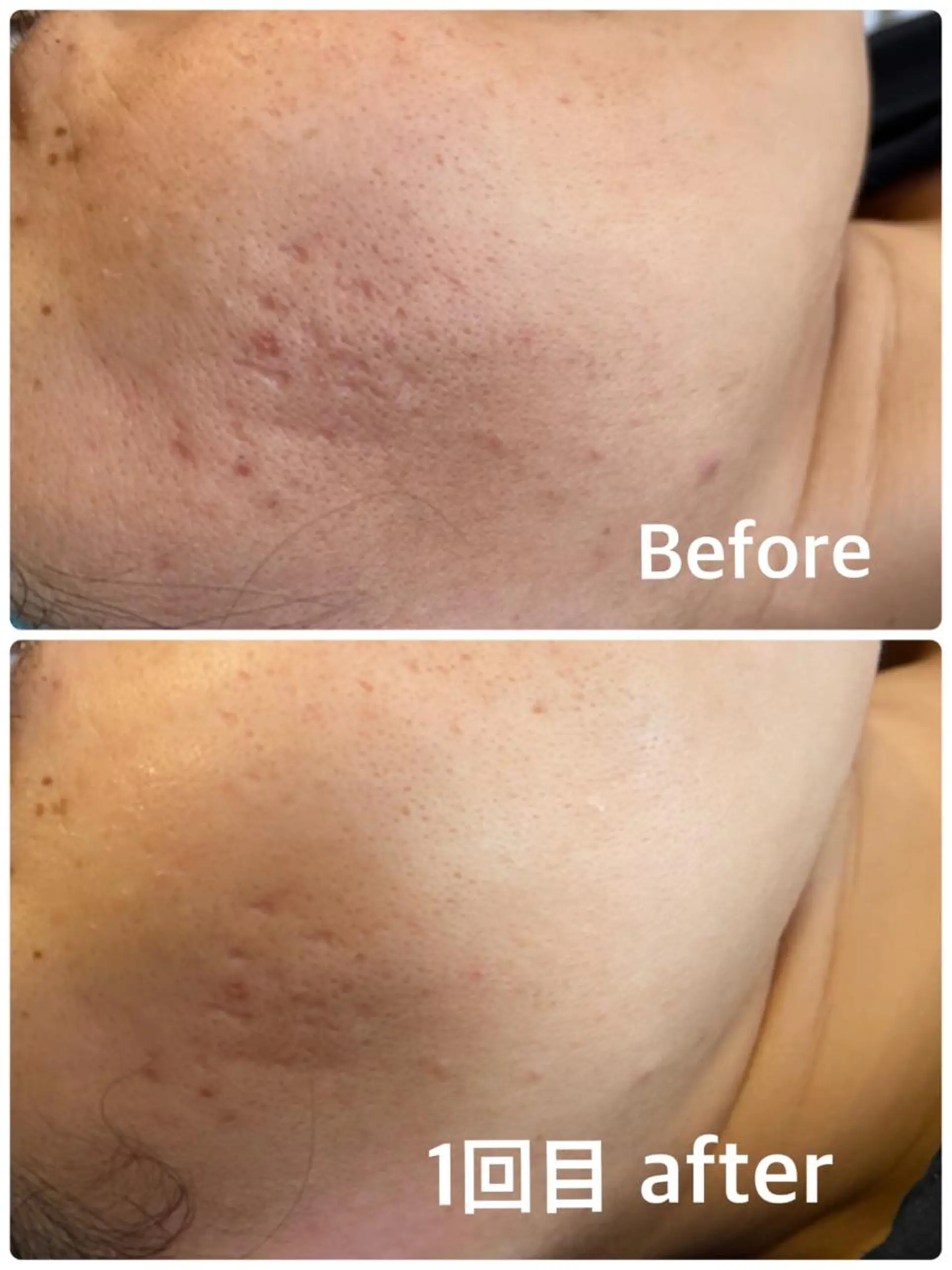 Eyelash studioのマツエク・マツパデザイン