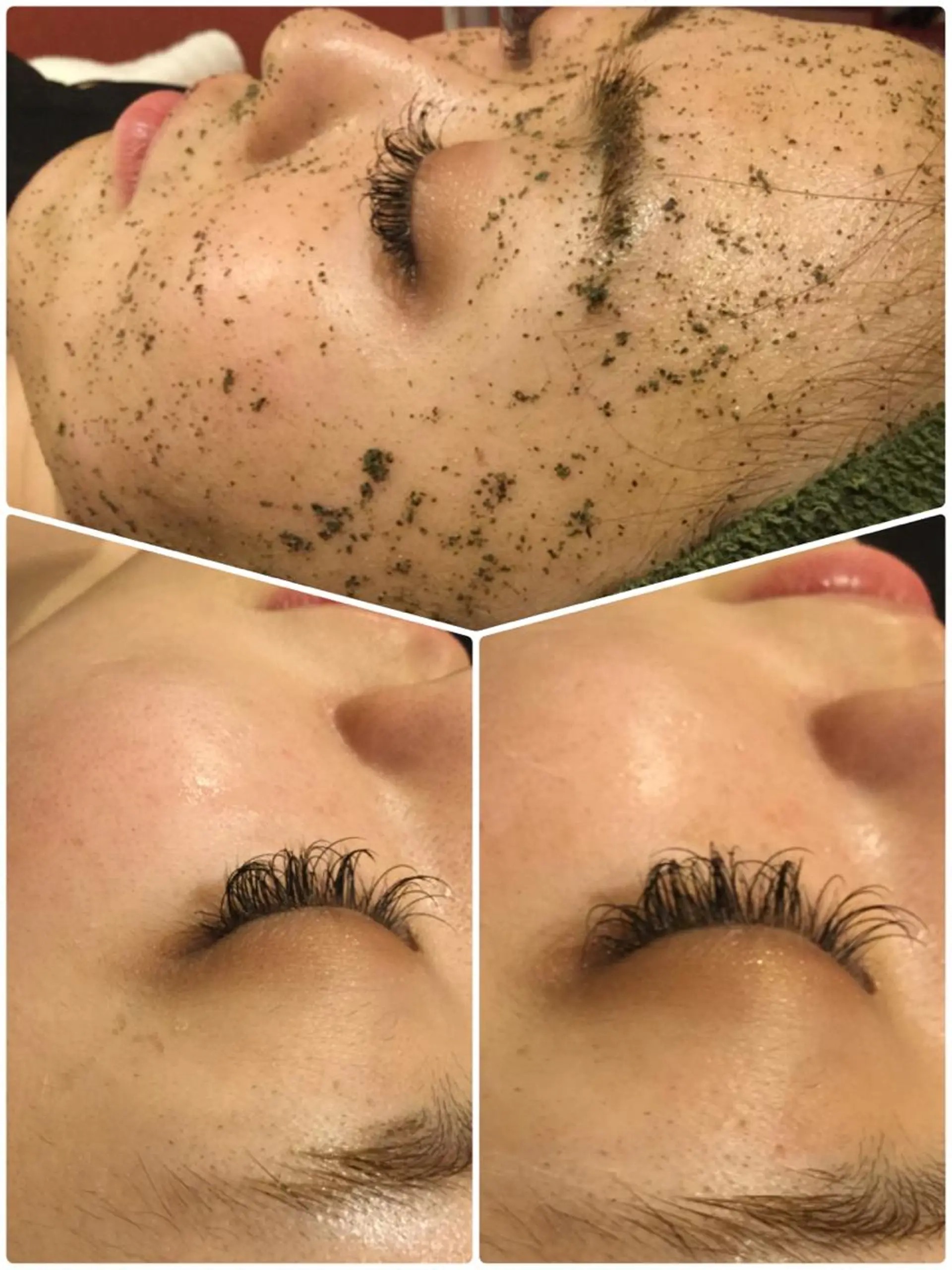 【リベルハーブピーリング認定店】敏感肌・美白脱毛専門店Dione立川店所属・Dione 立川店のエステ・リラクイメージ