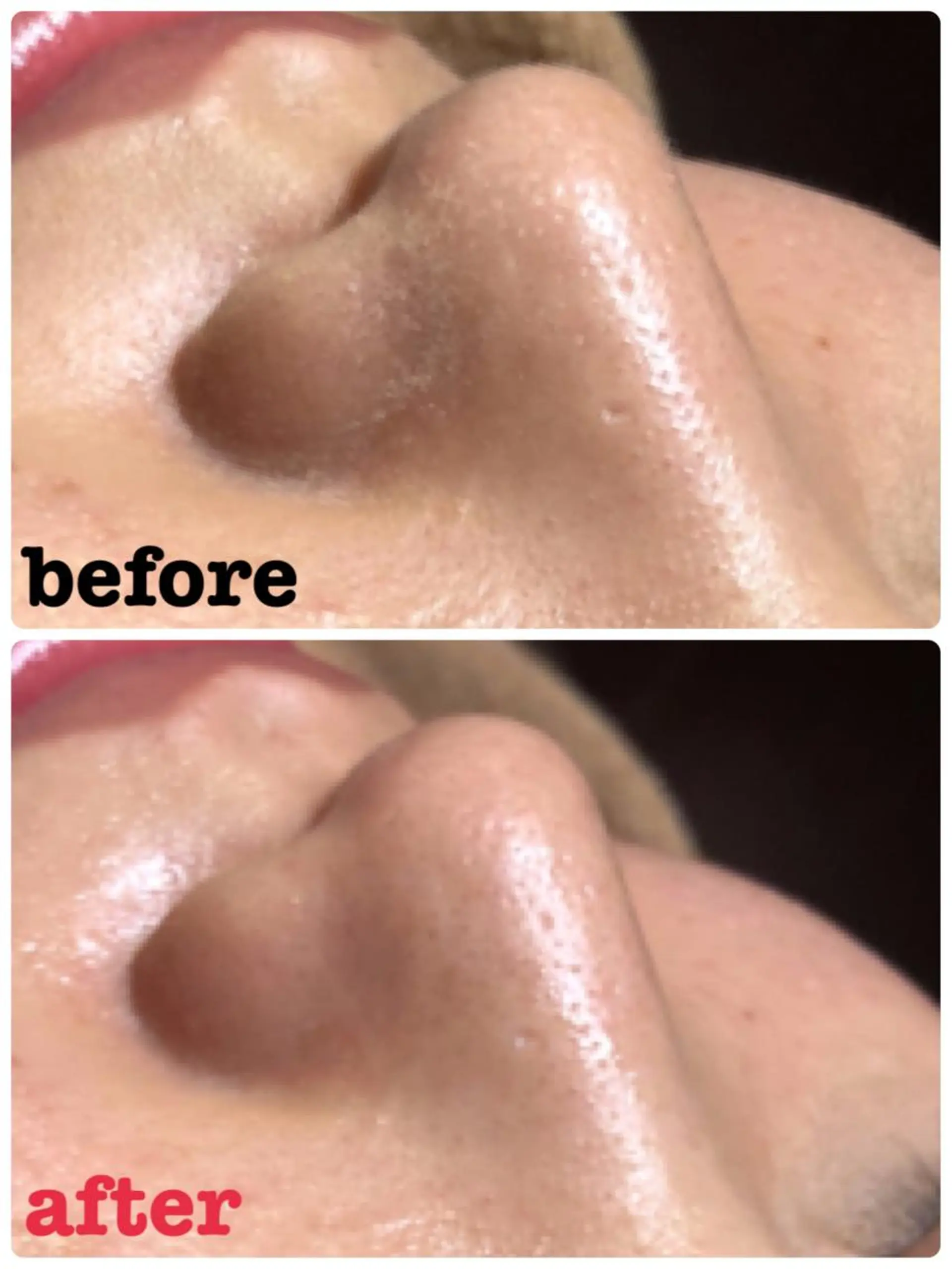 華~Hana~所属・シェービング& ネイル華~Hana~のネイルデザイン