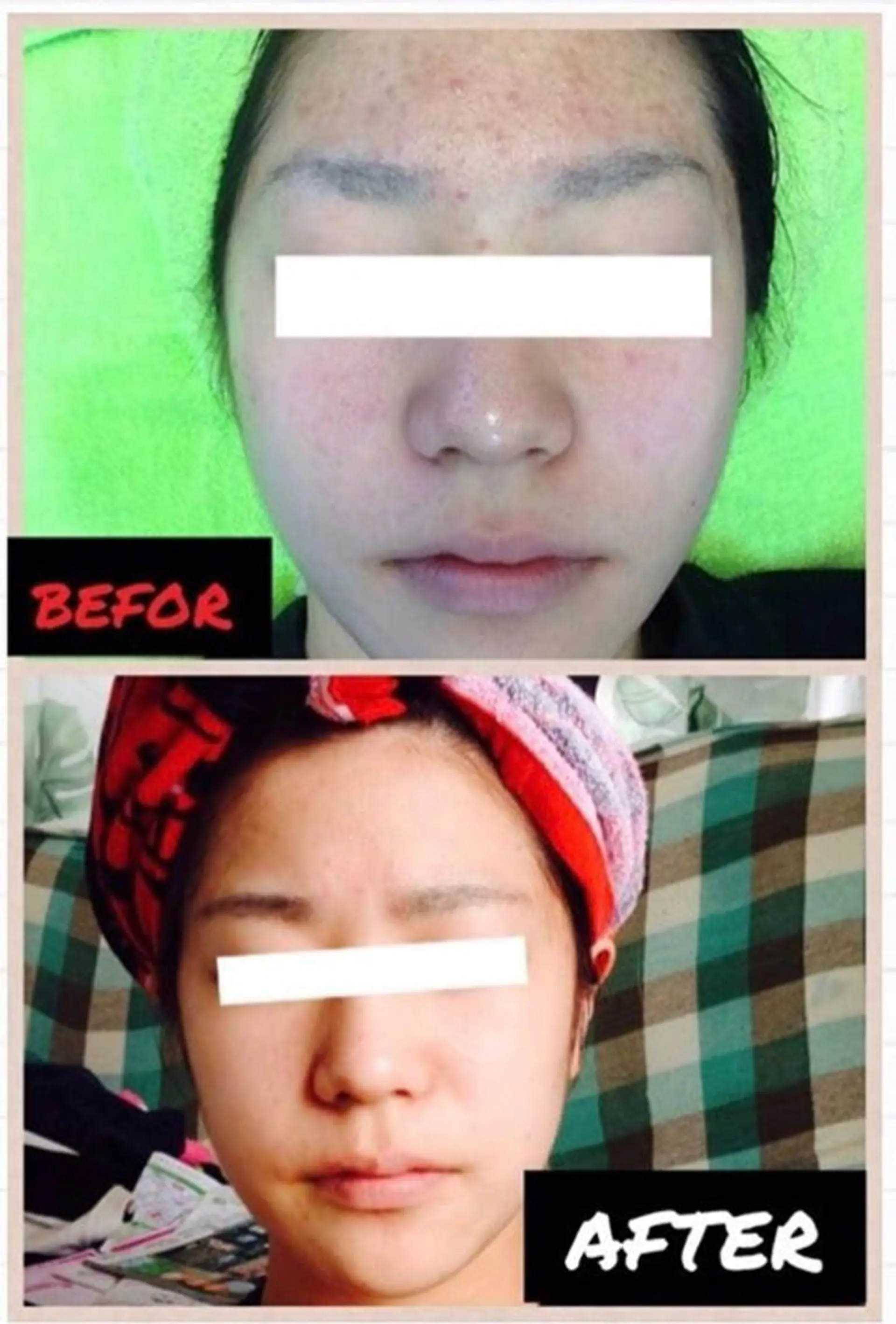 エステ 宇野澤 彩加のエステ・リラクイメージ