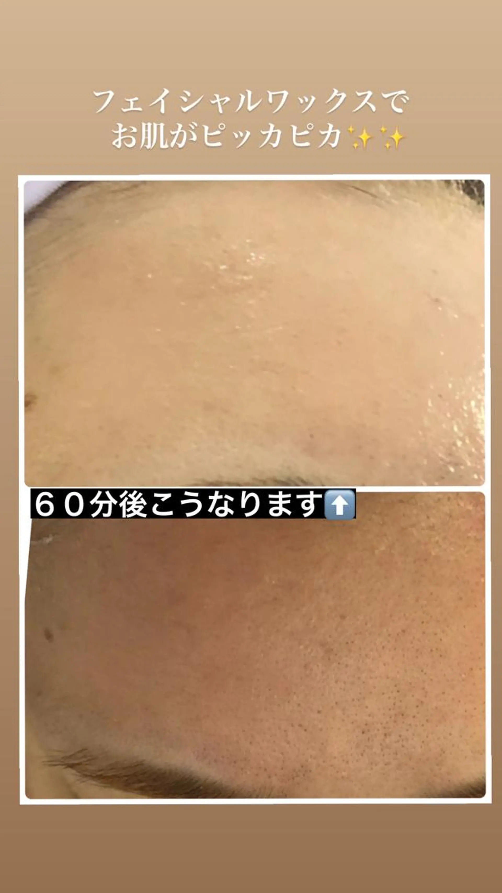 宜野湾美肌脱毛fuu okinawaタイラのエステ・リラクイメージ