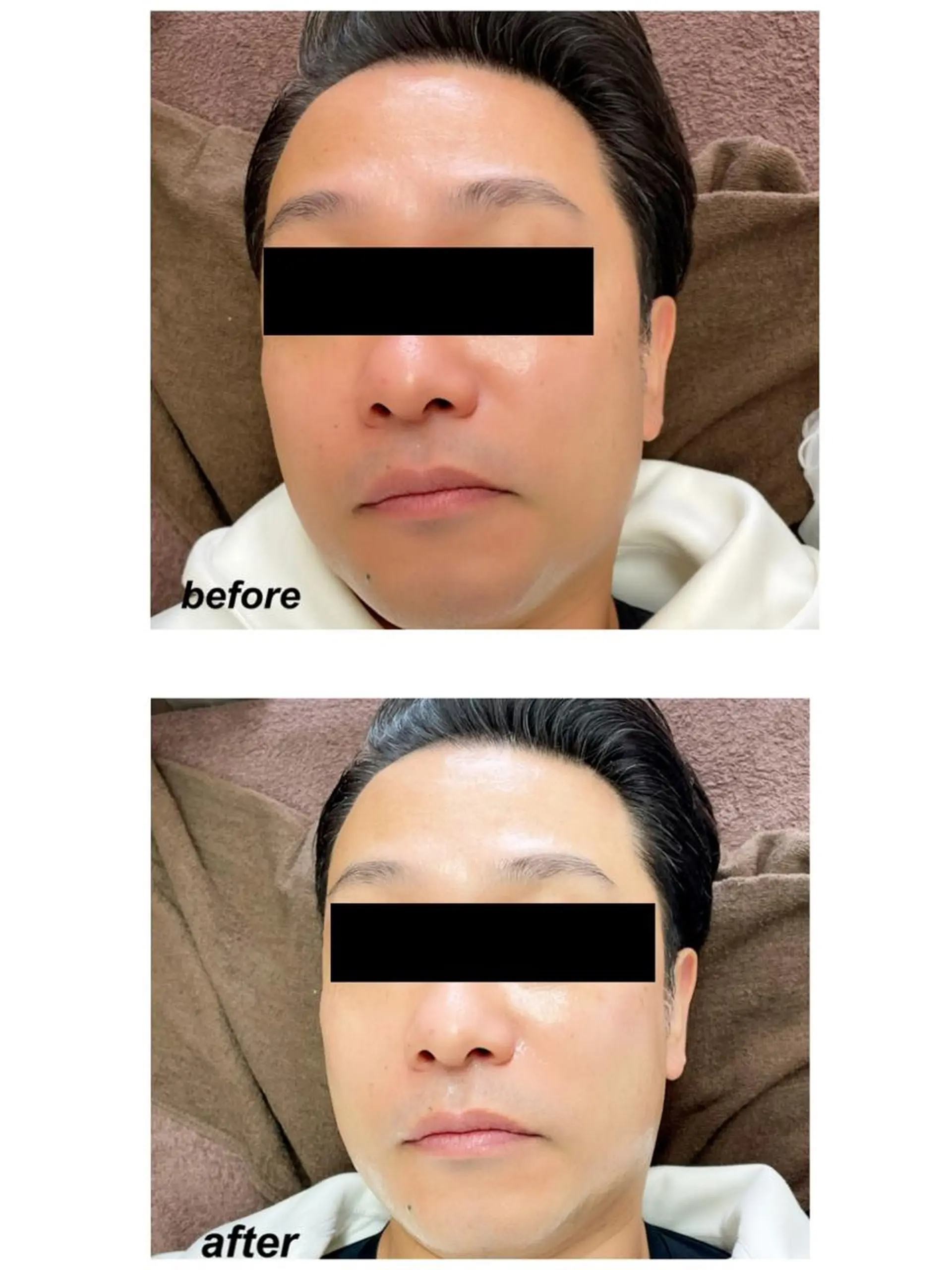 Laviere nail&脱毛サロンのエステ・リラクイメージ