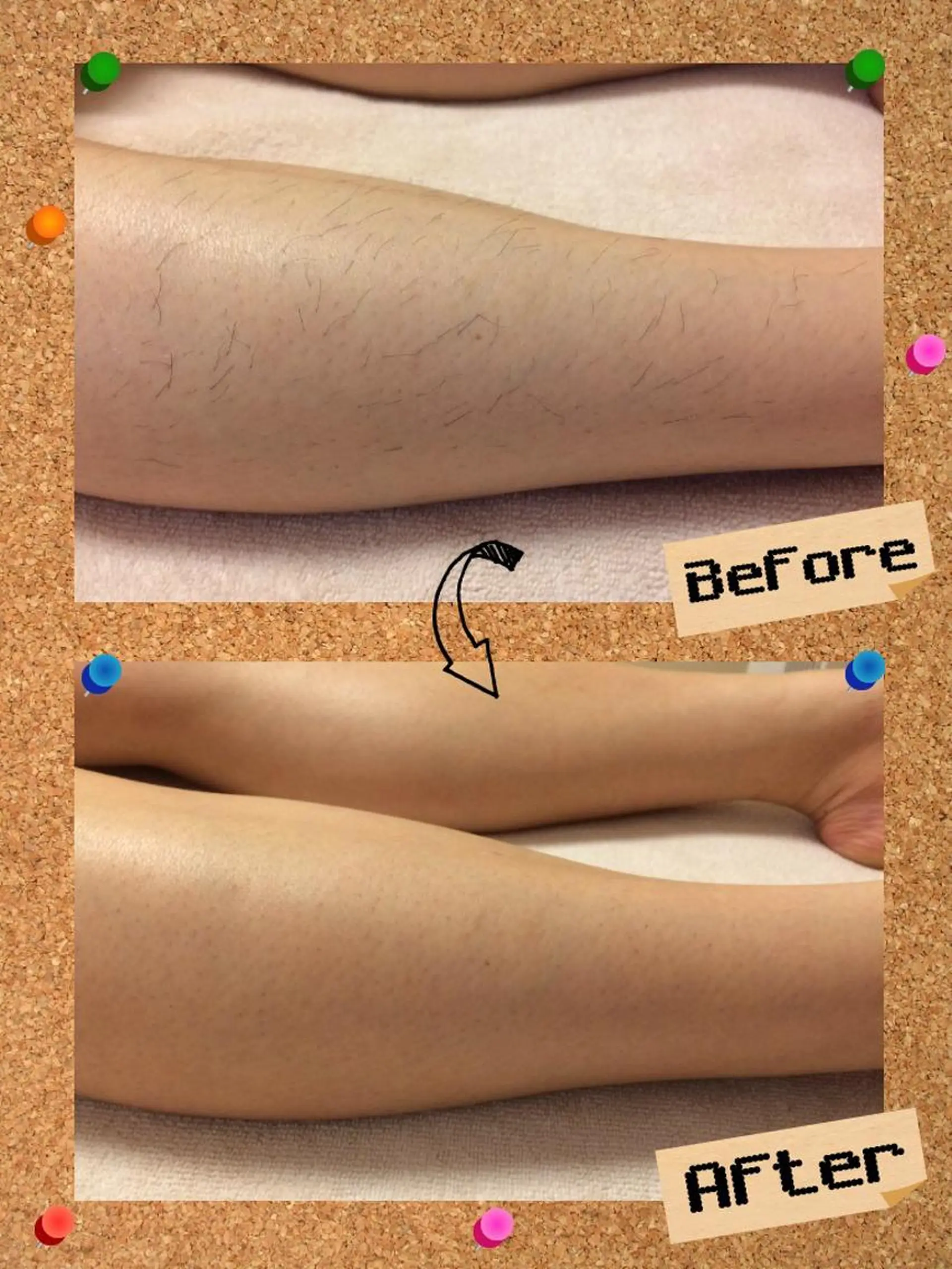 脱毛 大名 Kalon（カロン）のエステ・リラクイメージ