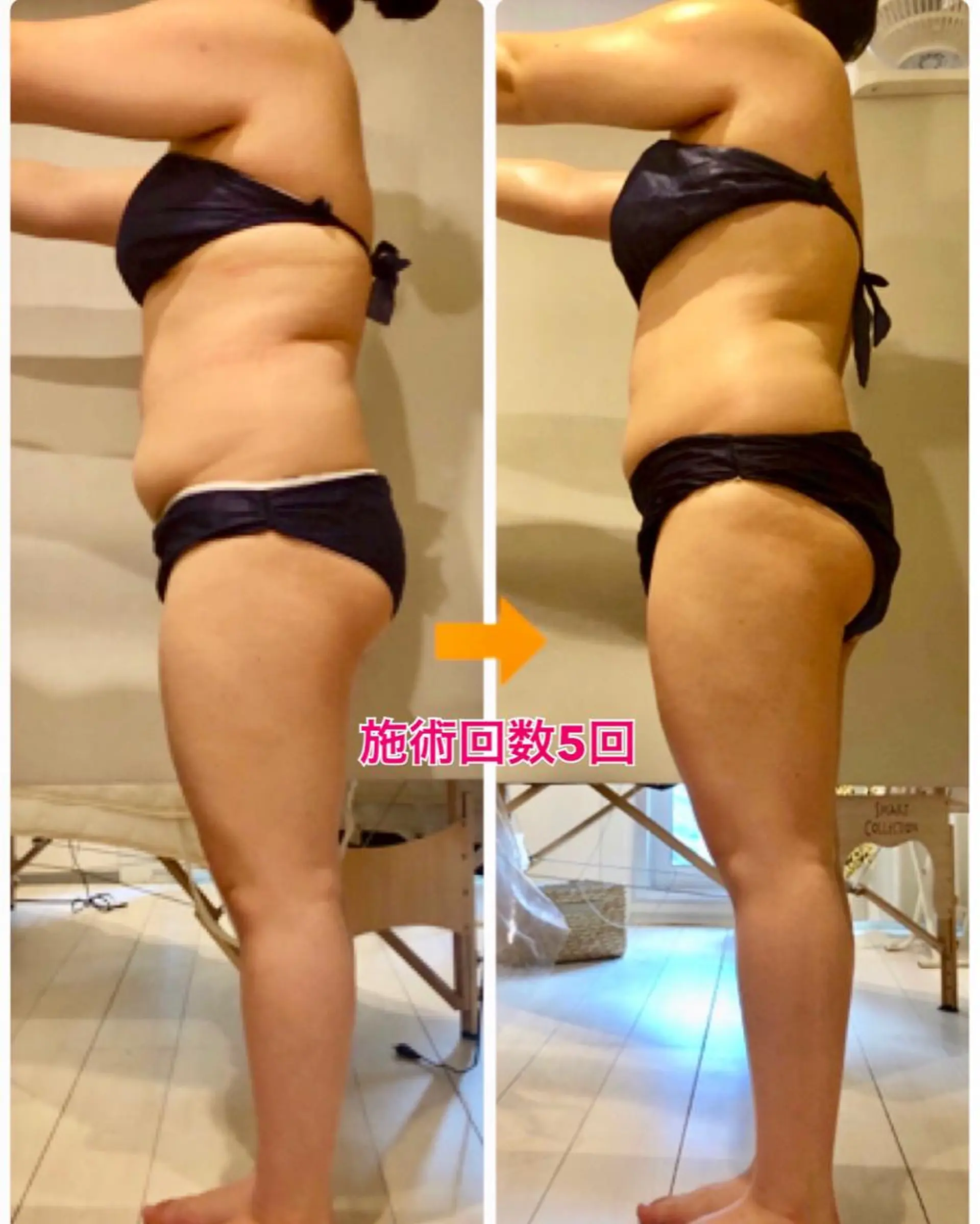 ショート カラー パーマ ヘアアレンジ メンズ キッズ ネイル マツエク・マツパ ‍痩身＆ボディ 結果出し🌟丹野のエステ・リラクイメージ