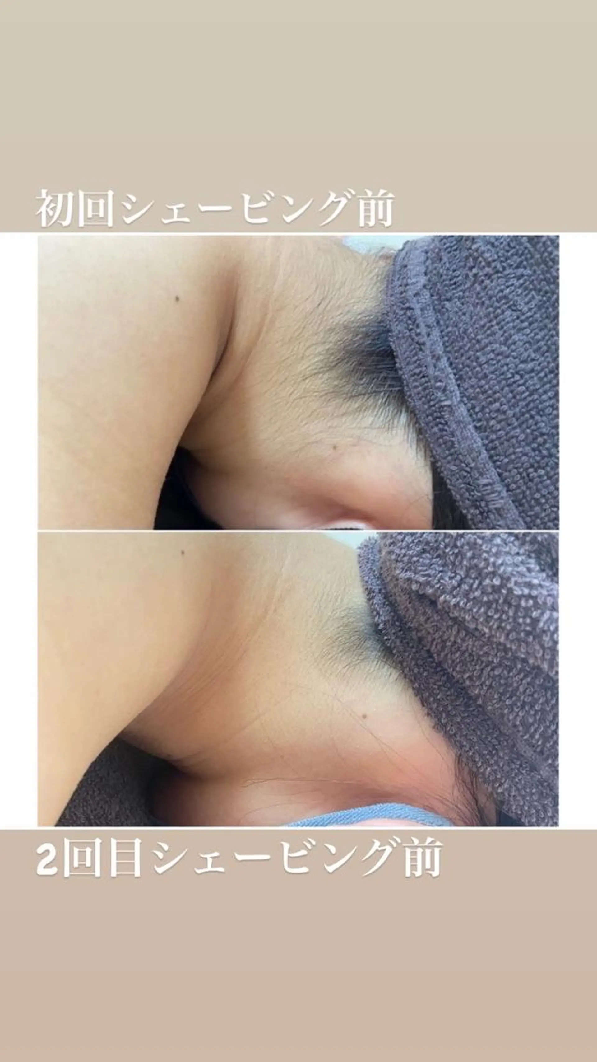 脱毛 Be Charm 山﨑のエステ・リラクイメージ