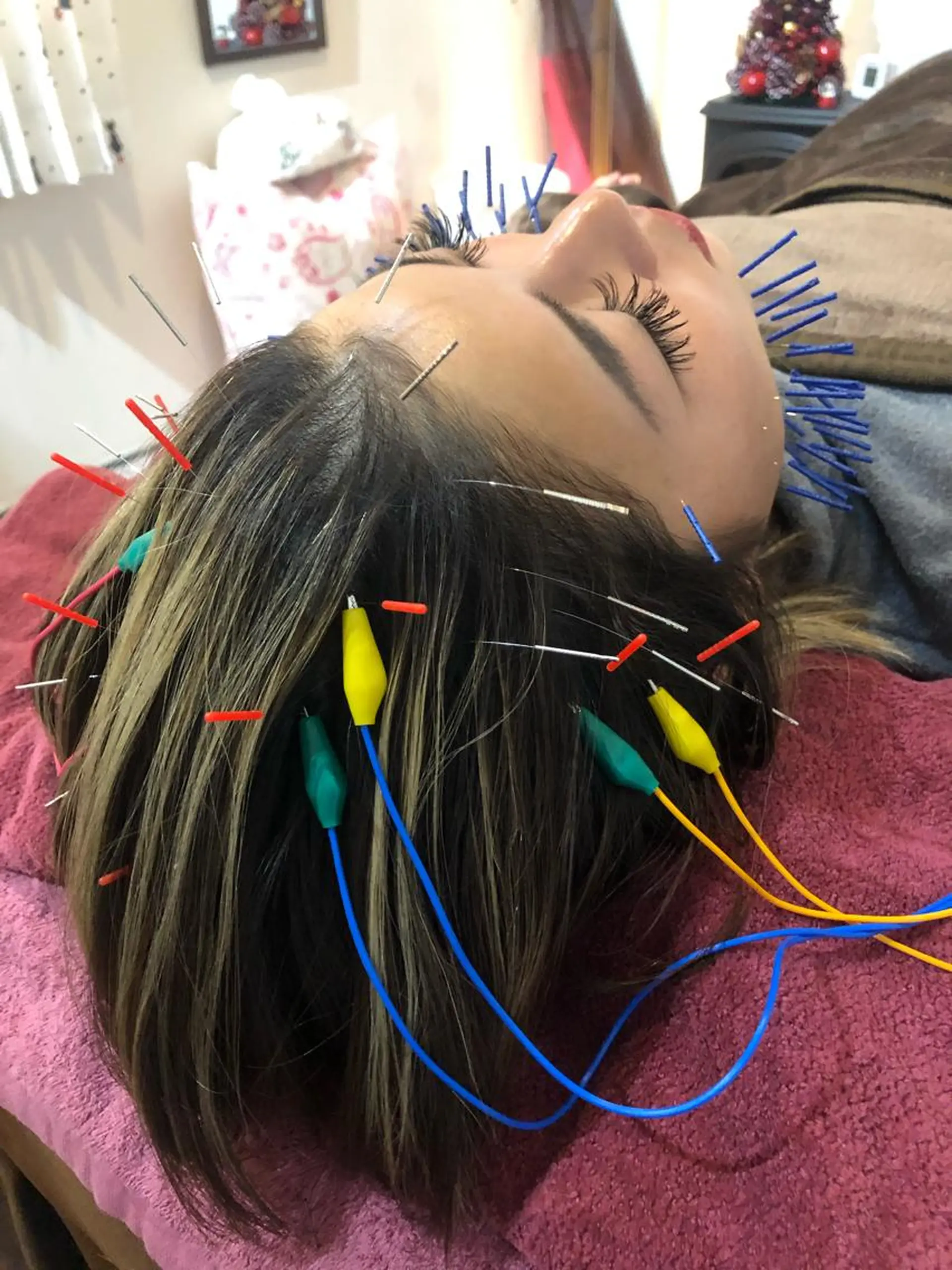 エステ リラク 美容鍼灸女性専用 りんご鍼灸治療院のその他イメージ