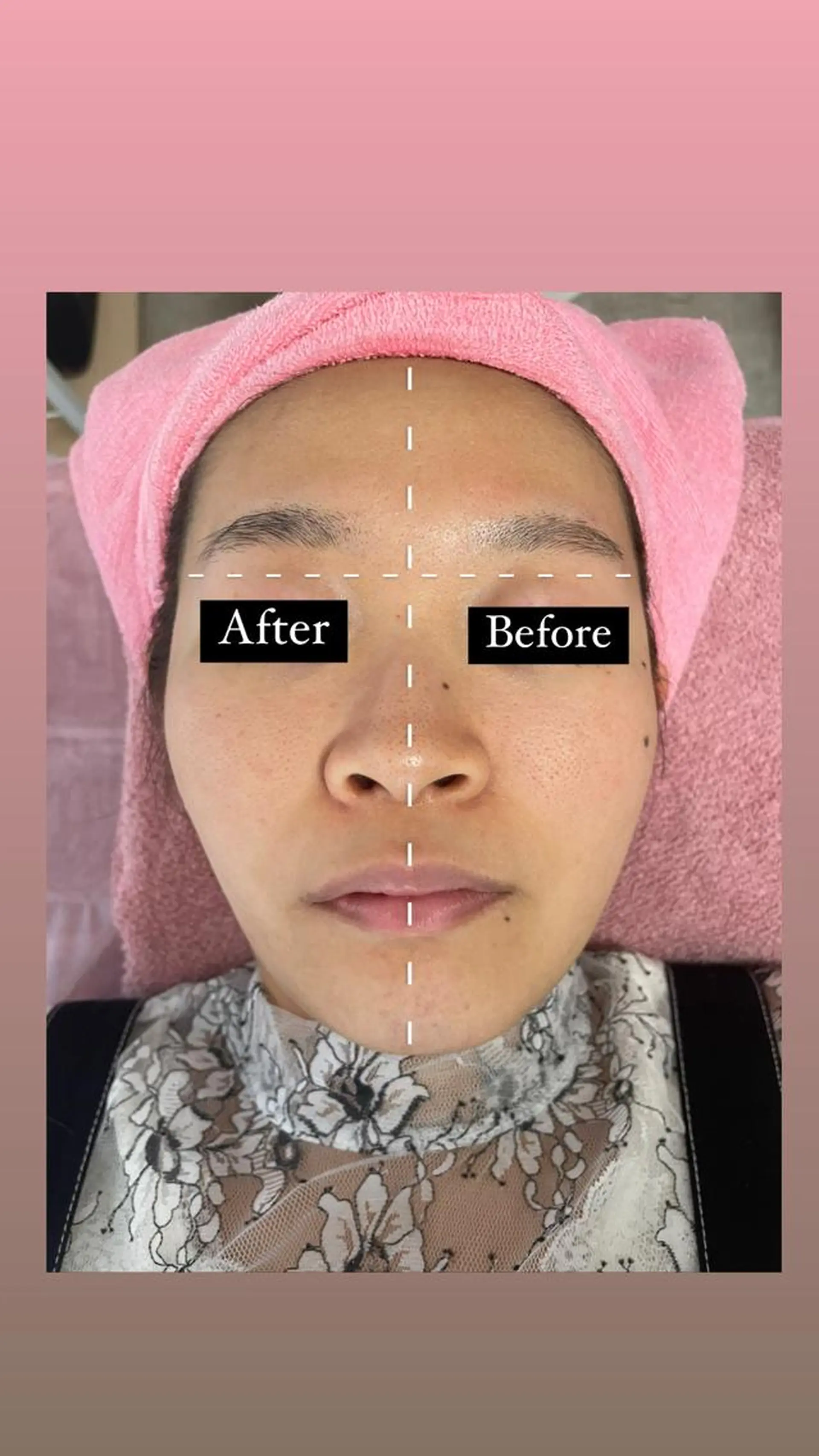 Linomalie エステ/たるみ/脱毛のエステ・リラクイメージ