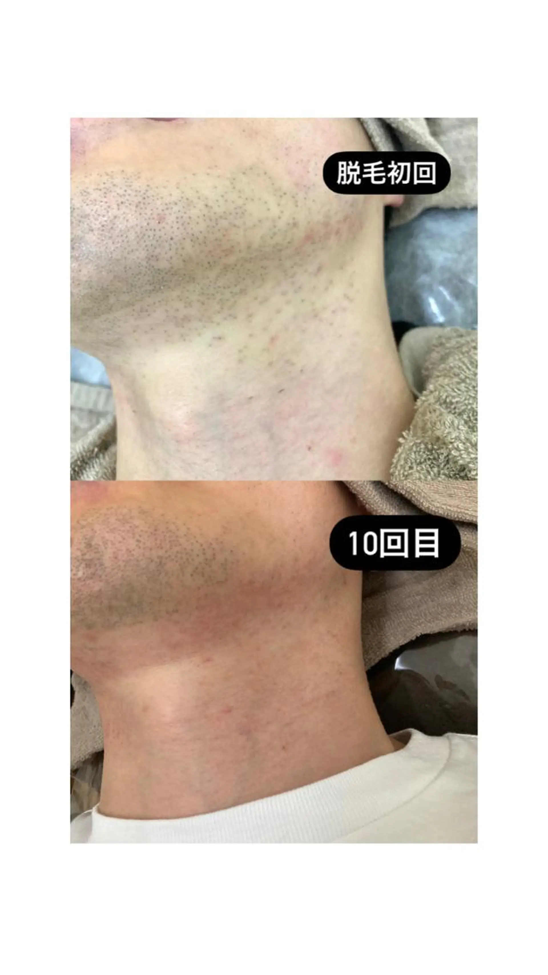 脱毛 脱毛サロン Lil所属・脱毛サロン Lilのエステ・リラクイメージ