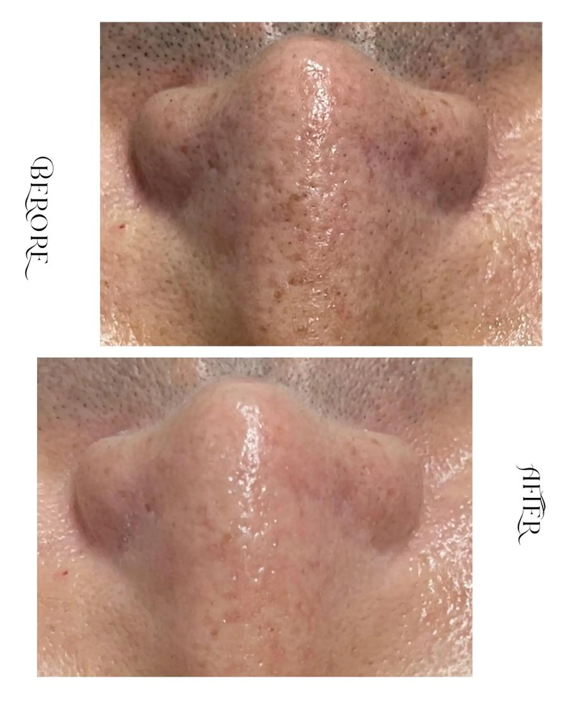 脱毛・肌質改善サロン Linoのエステ・リラクイメージ