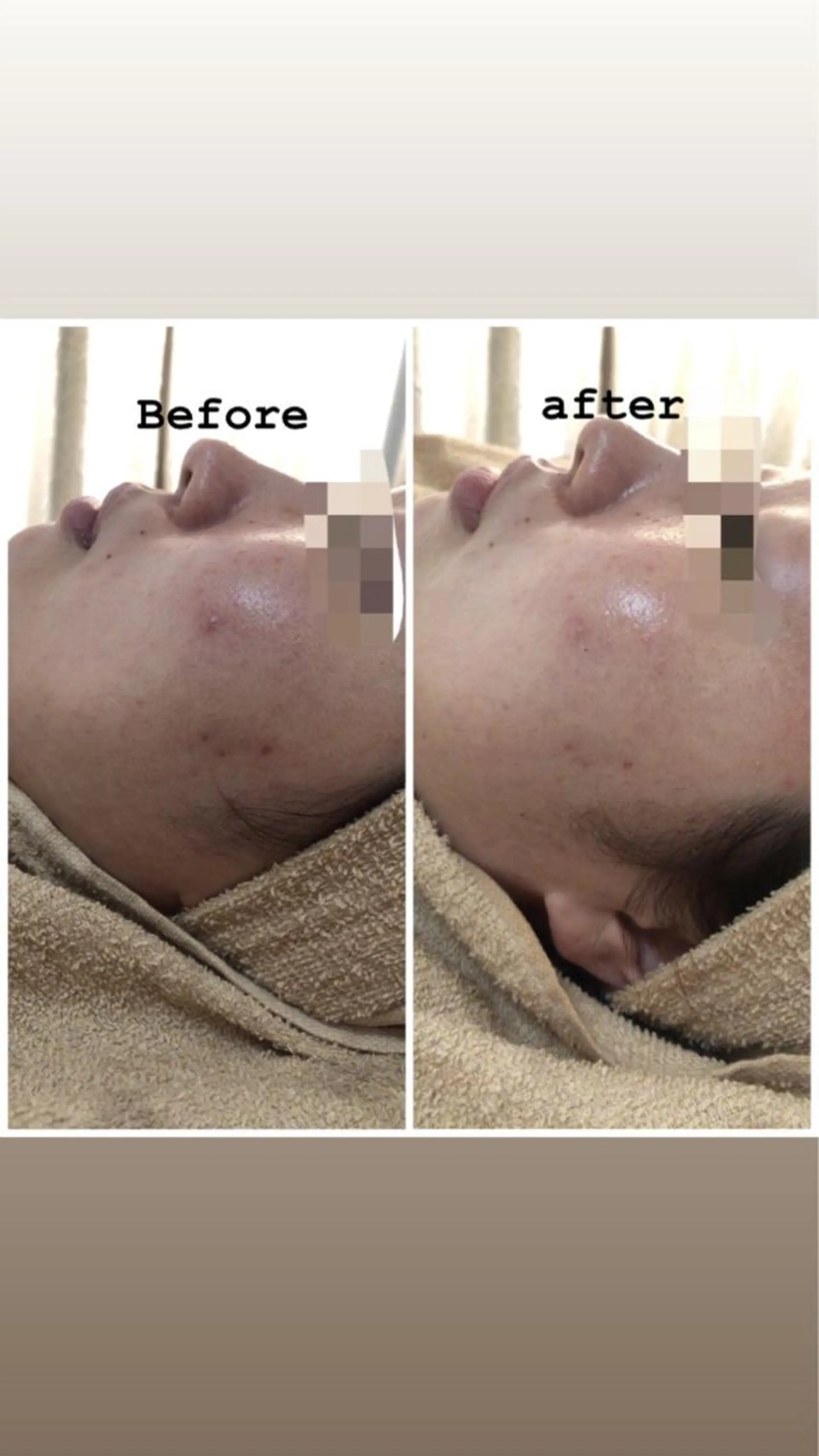 セミロング カラー パーマ ヘアアレンジ メンズ キッズ ネイル マツエク・マツパ Amaryllis 🌹のエステ・リラクイメージ