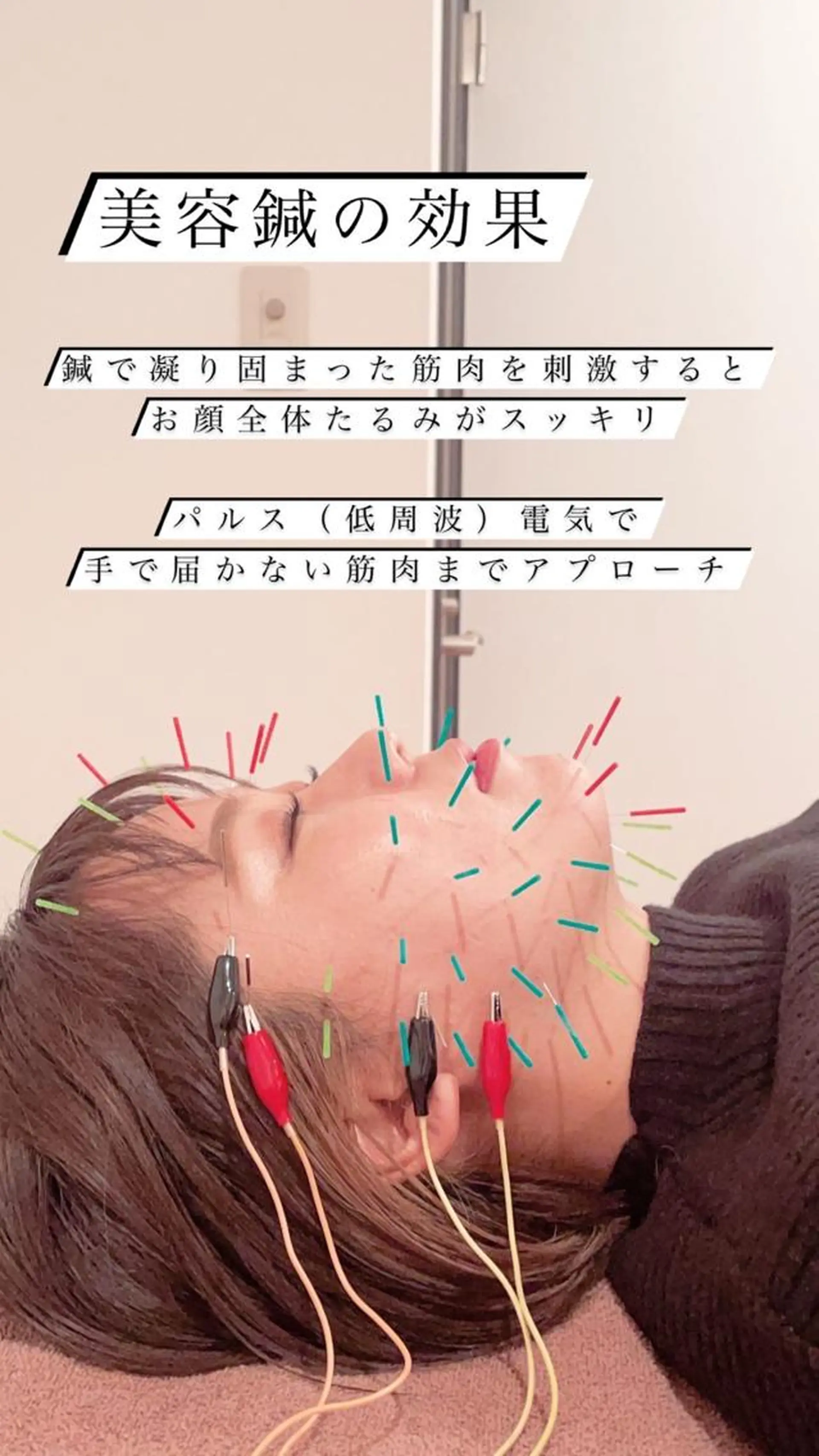 鍼灸サロン TIARA　美容鍼のエステ・リラクイメージ