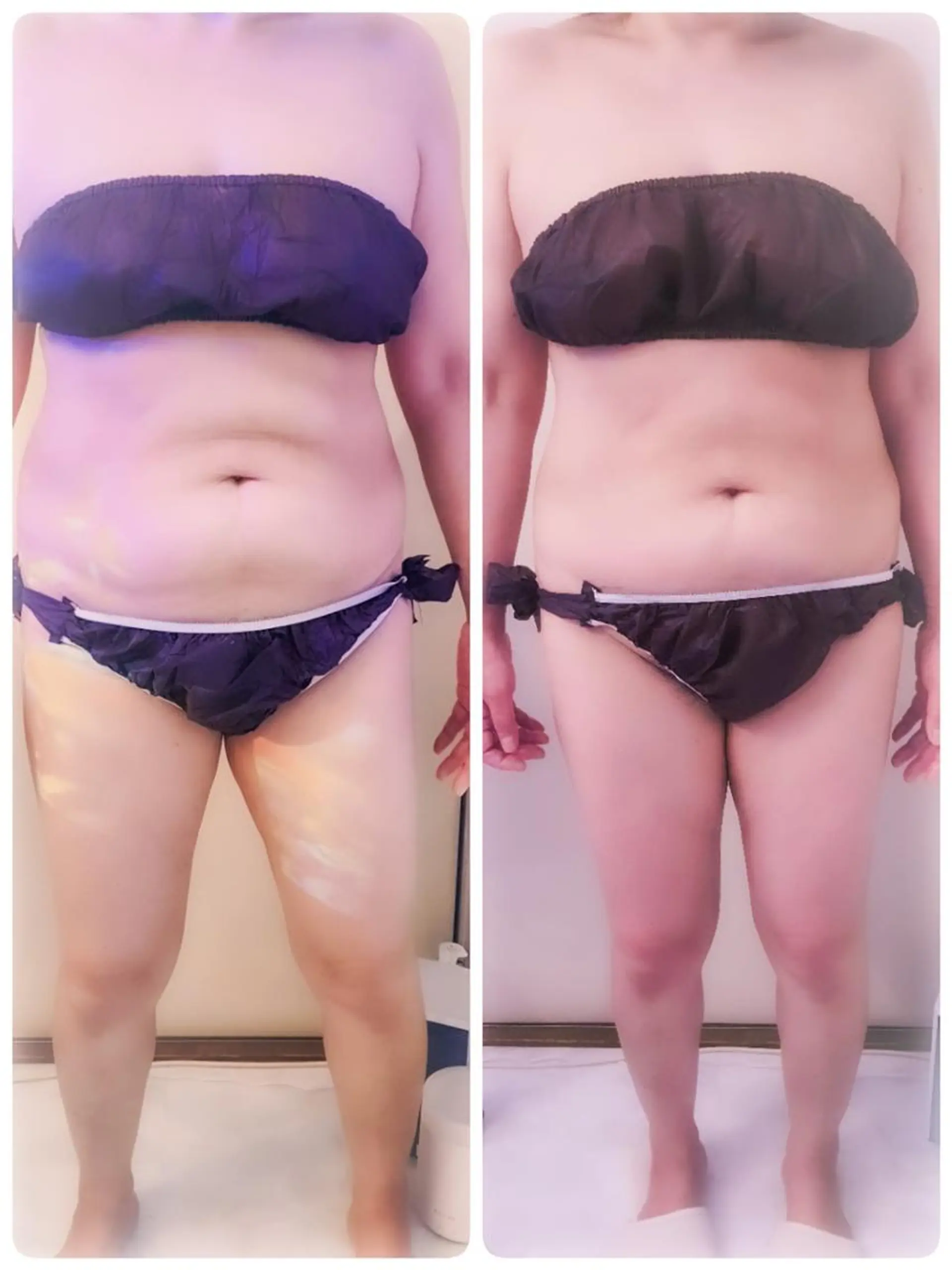 痩身ハーブピーリング 筋膜リリース☆B&Hのエステ・リラクイメージ