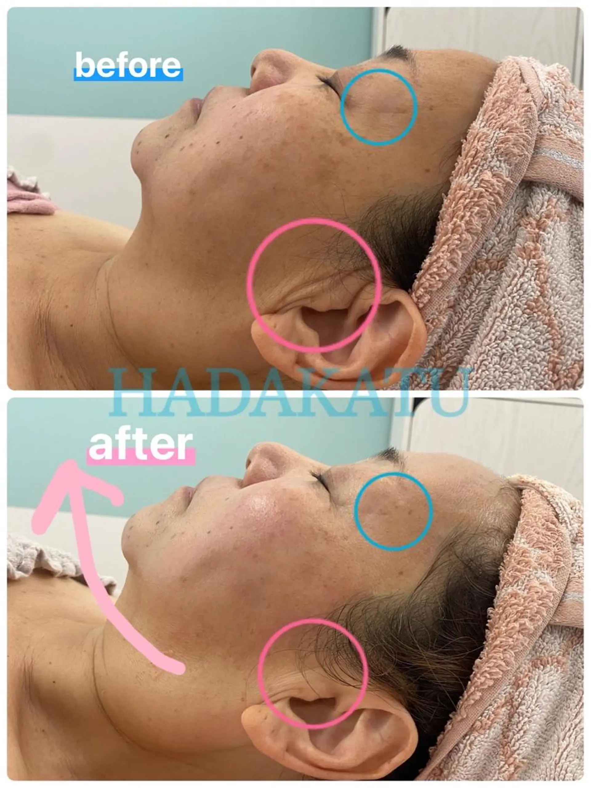 総合エステサロン 肌活のエステ・リラクイメージ