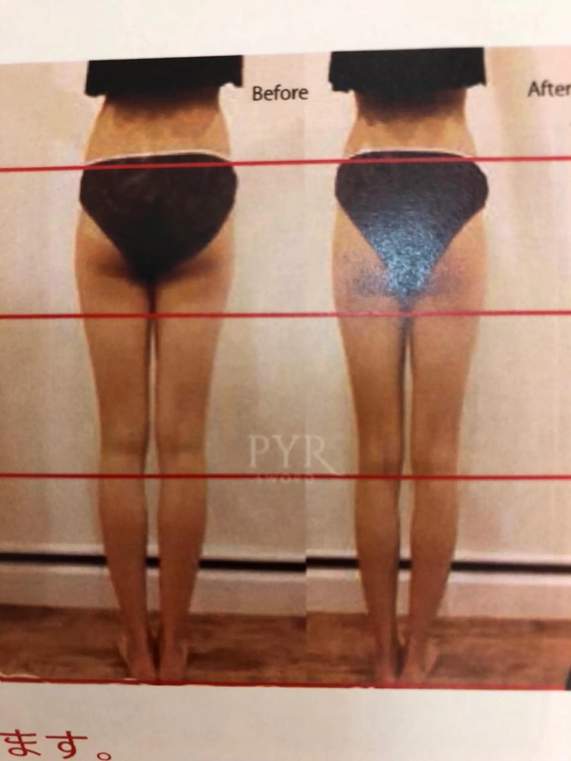 カラー マツエク・マツパ 美容鍼専門 ハリエンジュのエステ・リラクイメージ