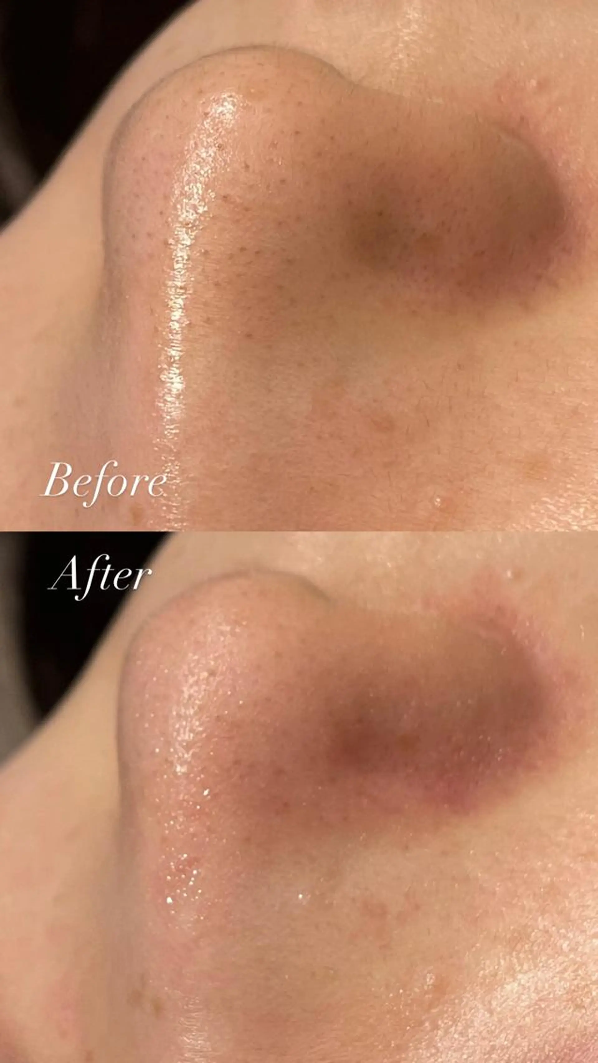 Lilyboo 多田のエステ・リラクイメージ