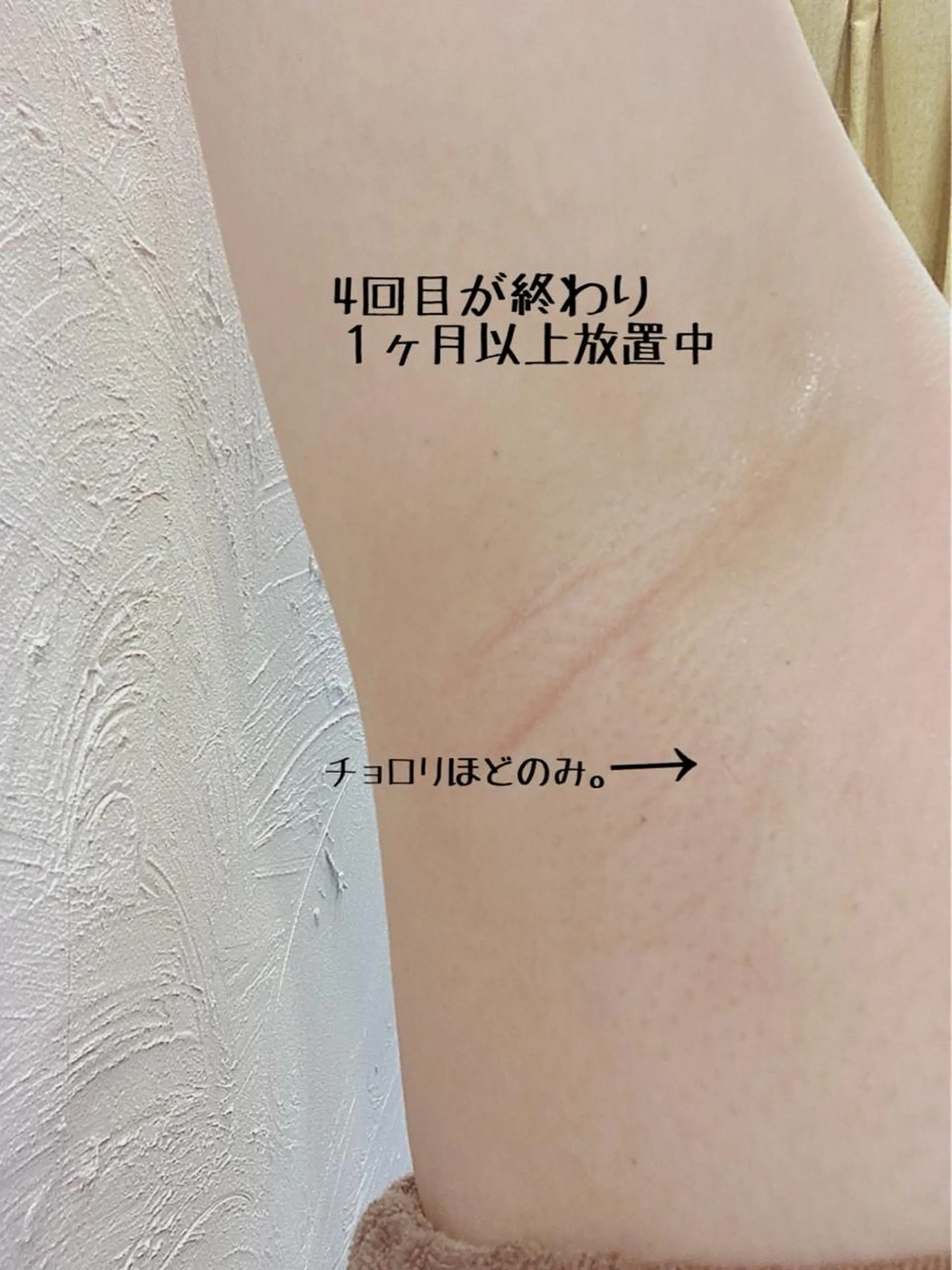 脱毛 セルフ脱毛 atelier aoのエステ・リラクイメージ