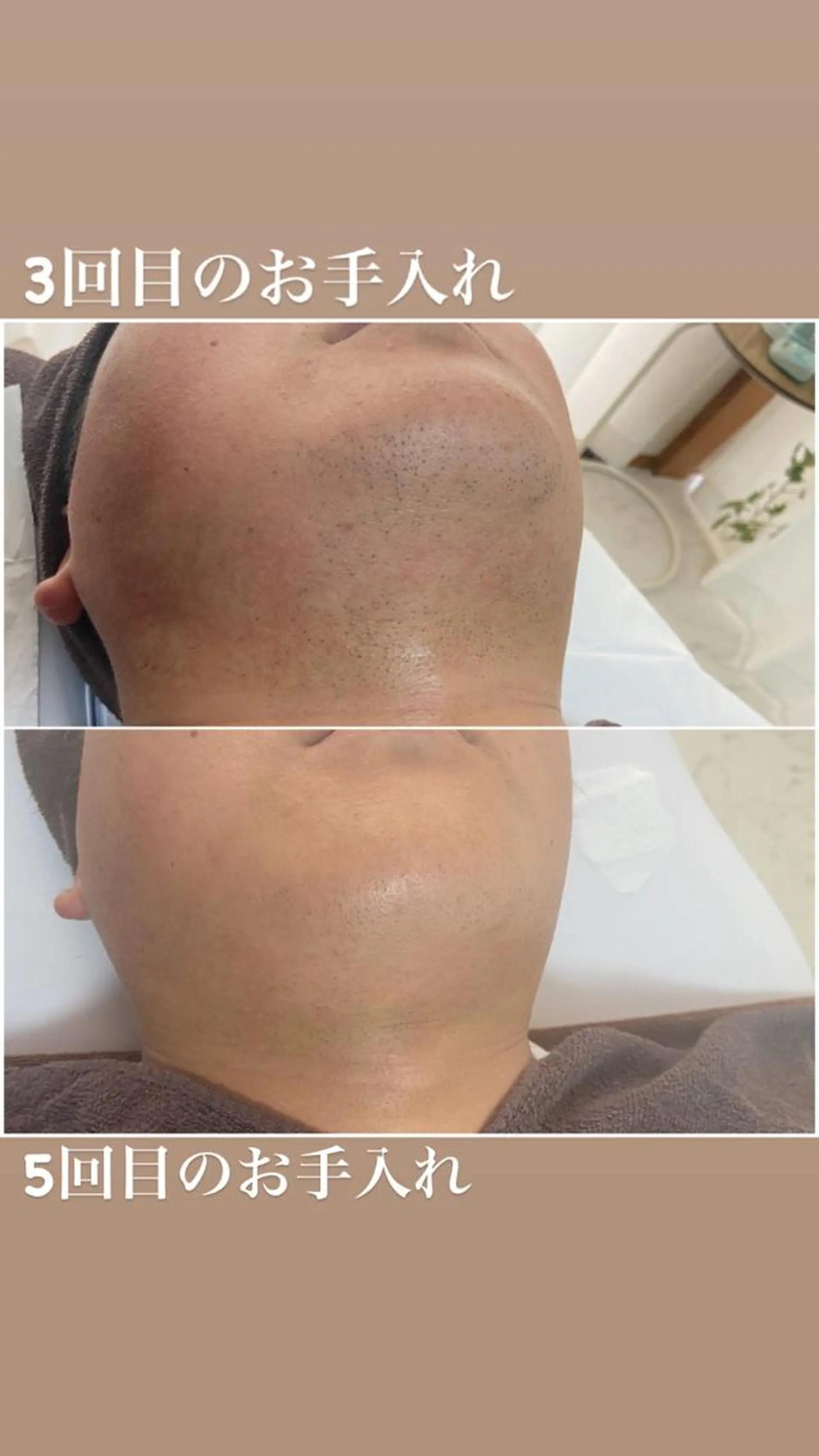 メンズ 脱毛 Be Charm 山﨑のエステ・リラクイメージ