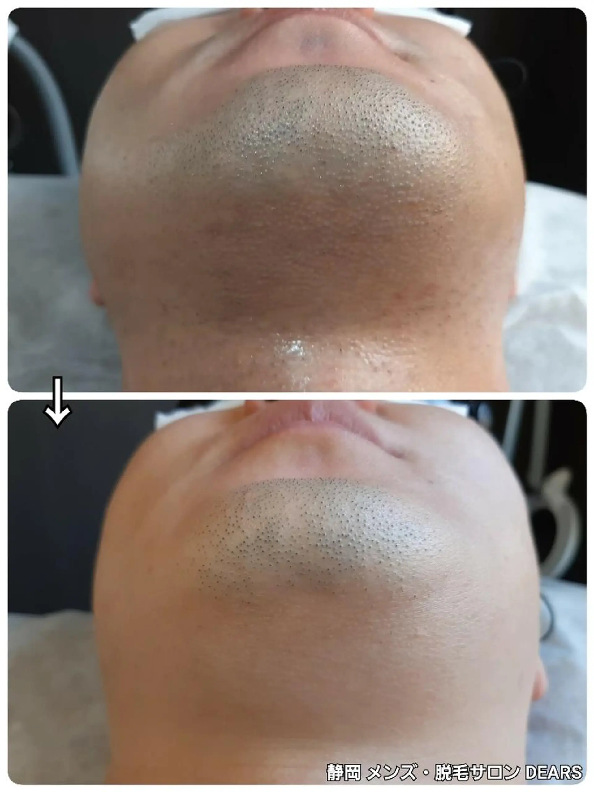 キッズ メンズ メンズ・脱毛サロン DEARS所属・山村幸久 メンズ脱毛 ディアーズのエステ・リラクイメージ