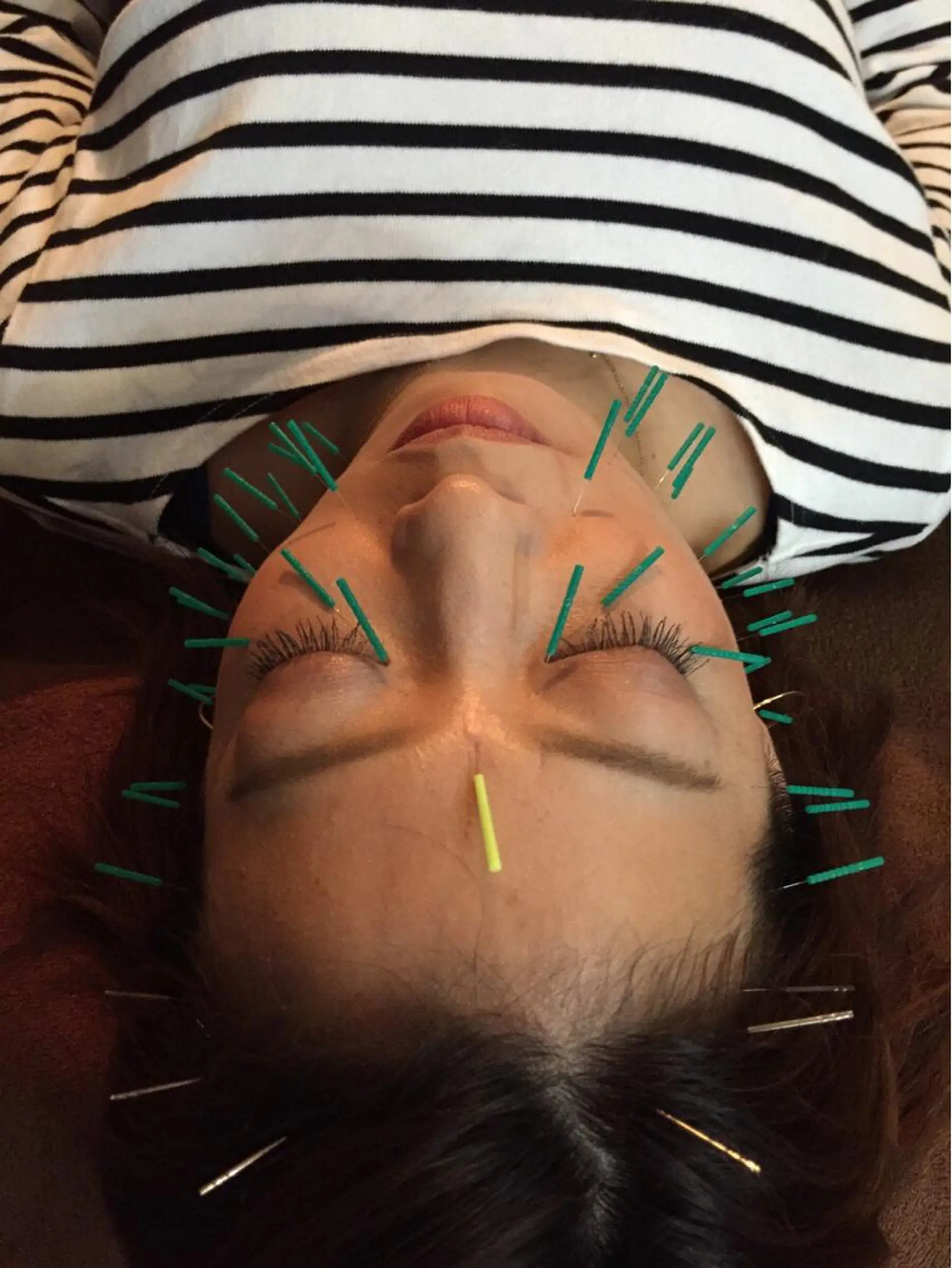 エステ リラク 美容鍼灸イロドリ のエステ・リラクイメージ