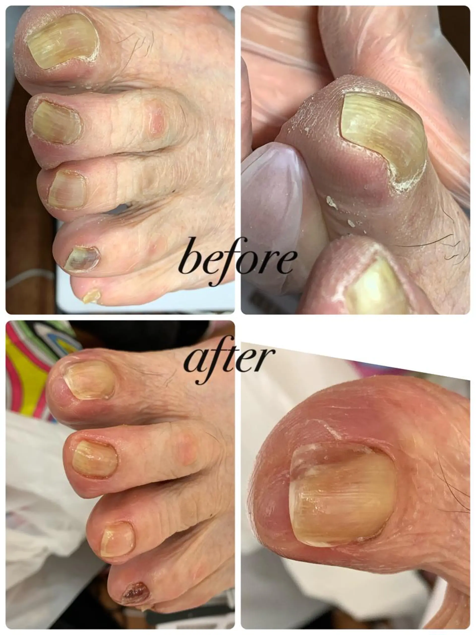 ネイル メンズトータルビューティーwellnessMARCA所属・【メンズサロン】 MARCAのエステ・リラクイメージ