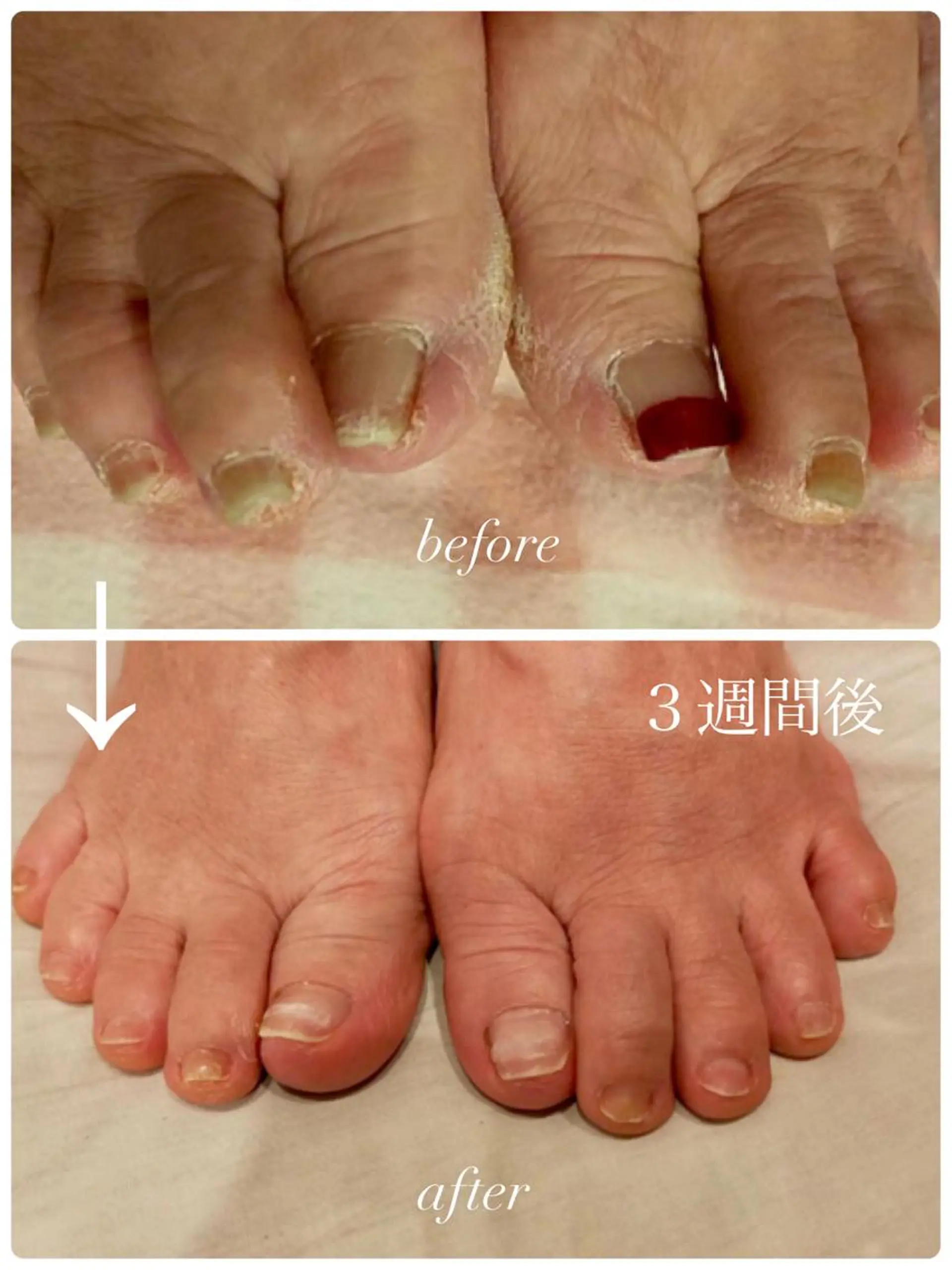 ネイル ジェルネイル nail salon Rのネイルデザイン