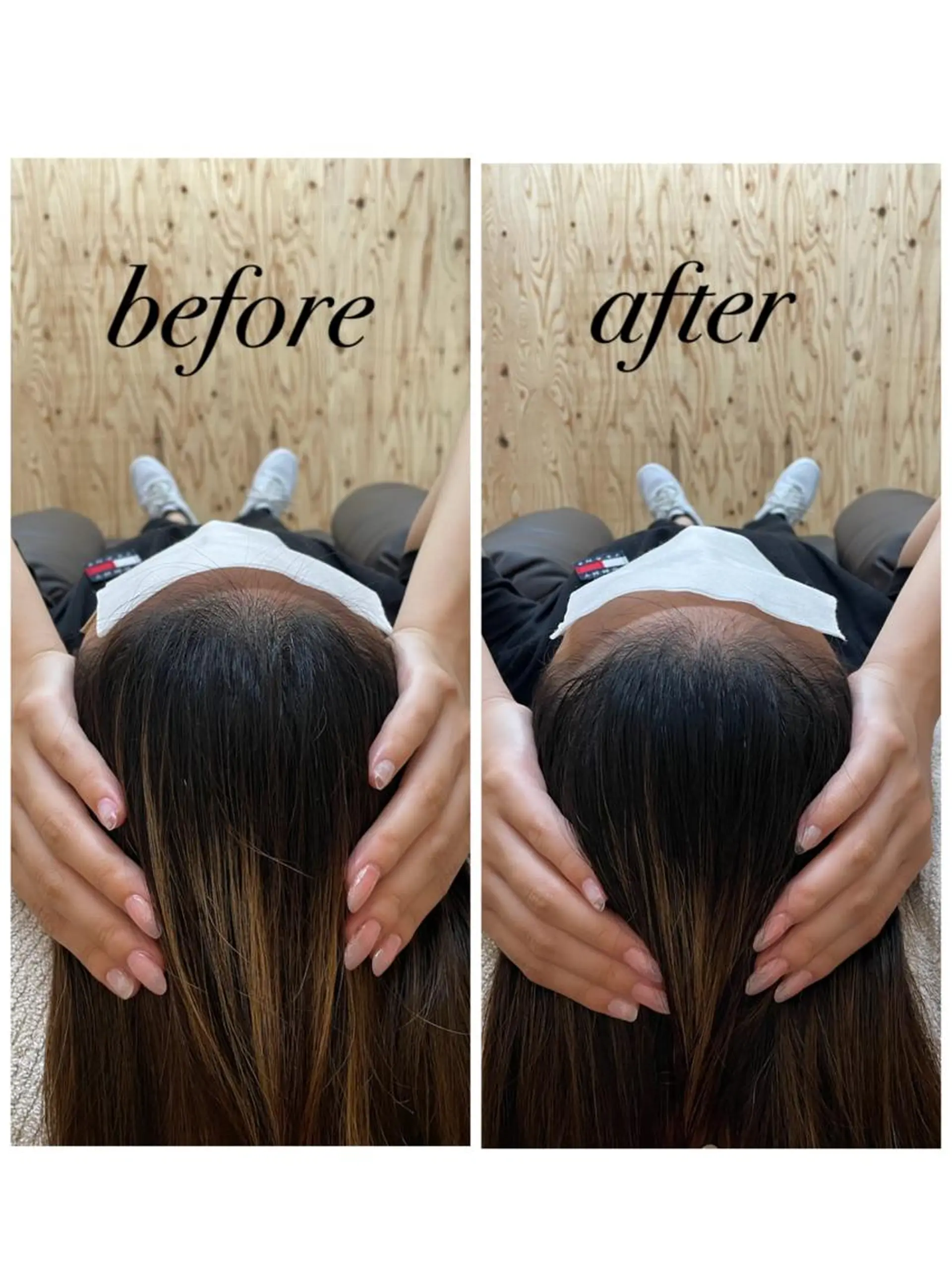 リラク ate'所属・個室ドライヘッドスパ 🍃moriのエステ・リラクイメージ