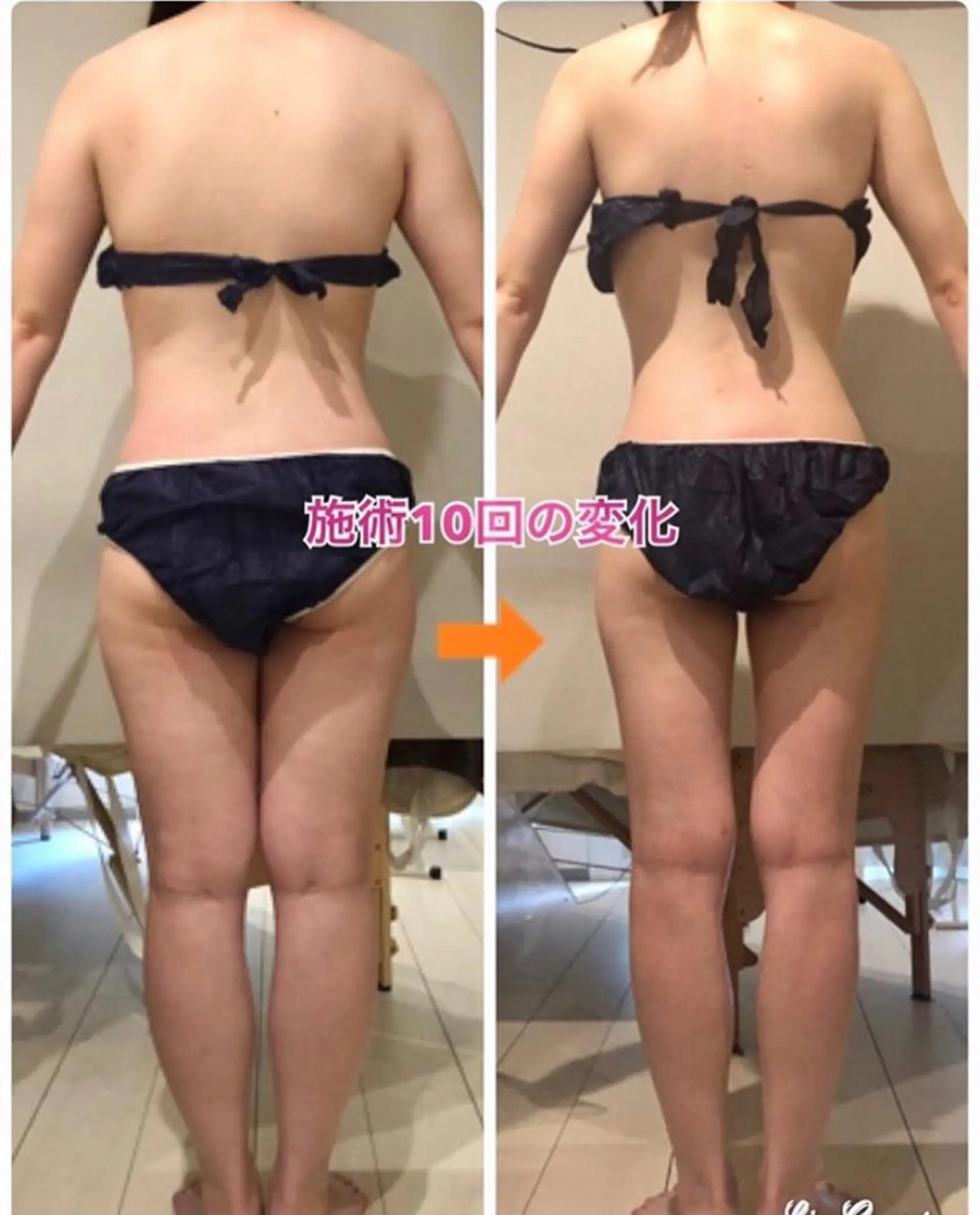 ショート カラー パーマ ヘアアレンジ メンズ キッズ ネイル マツエク・マツパ エステ リラク ‍痩身＆ボディ 結果出し🌟丹野のエステ・リラクイメージ