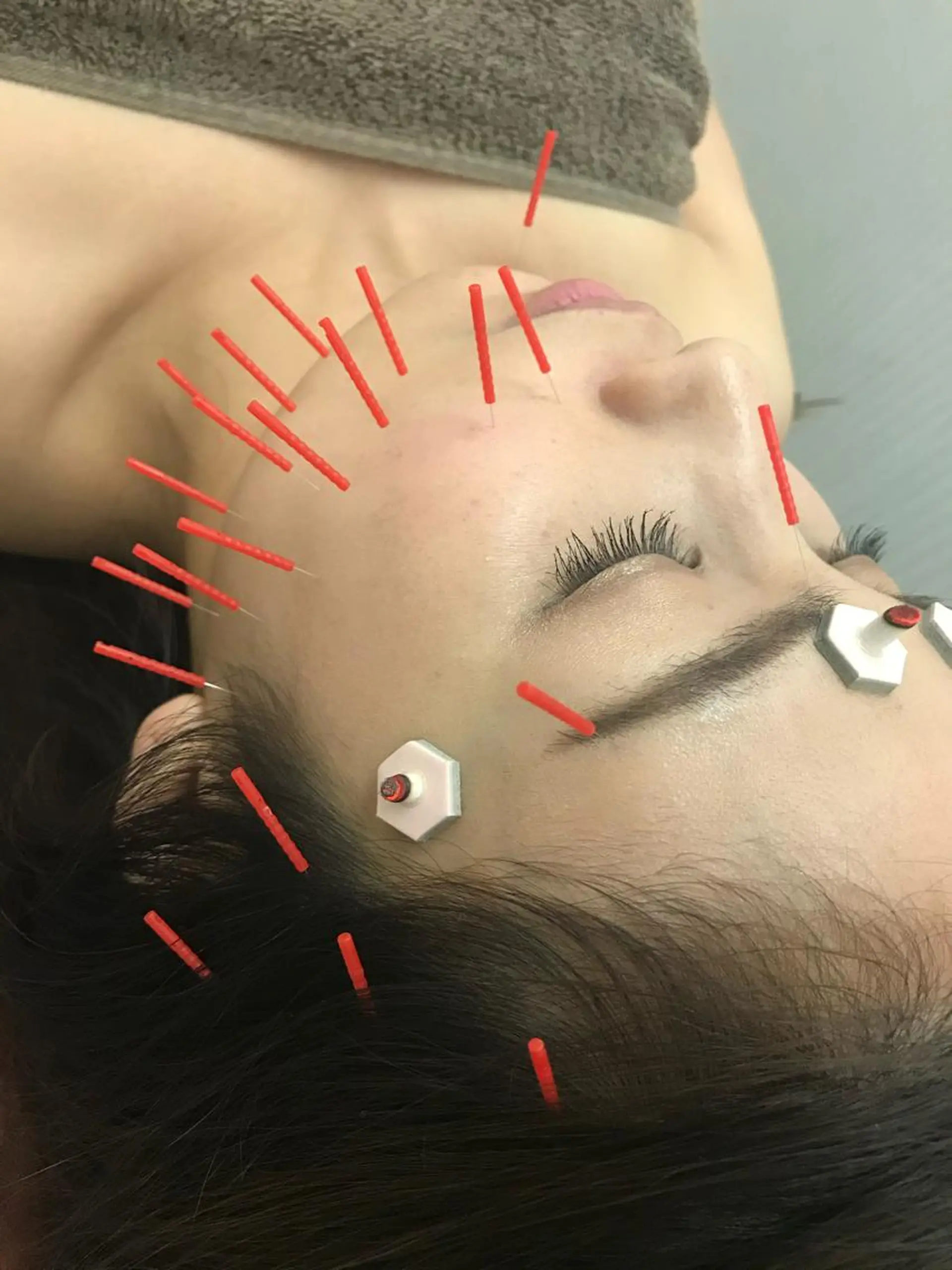 かずき鍼灸整骨院所属・鈴木 歩のその他イメージ