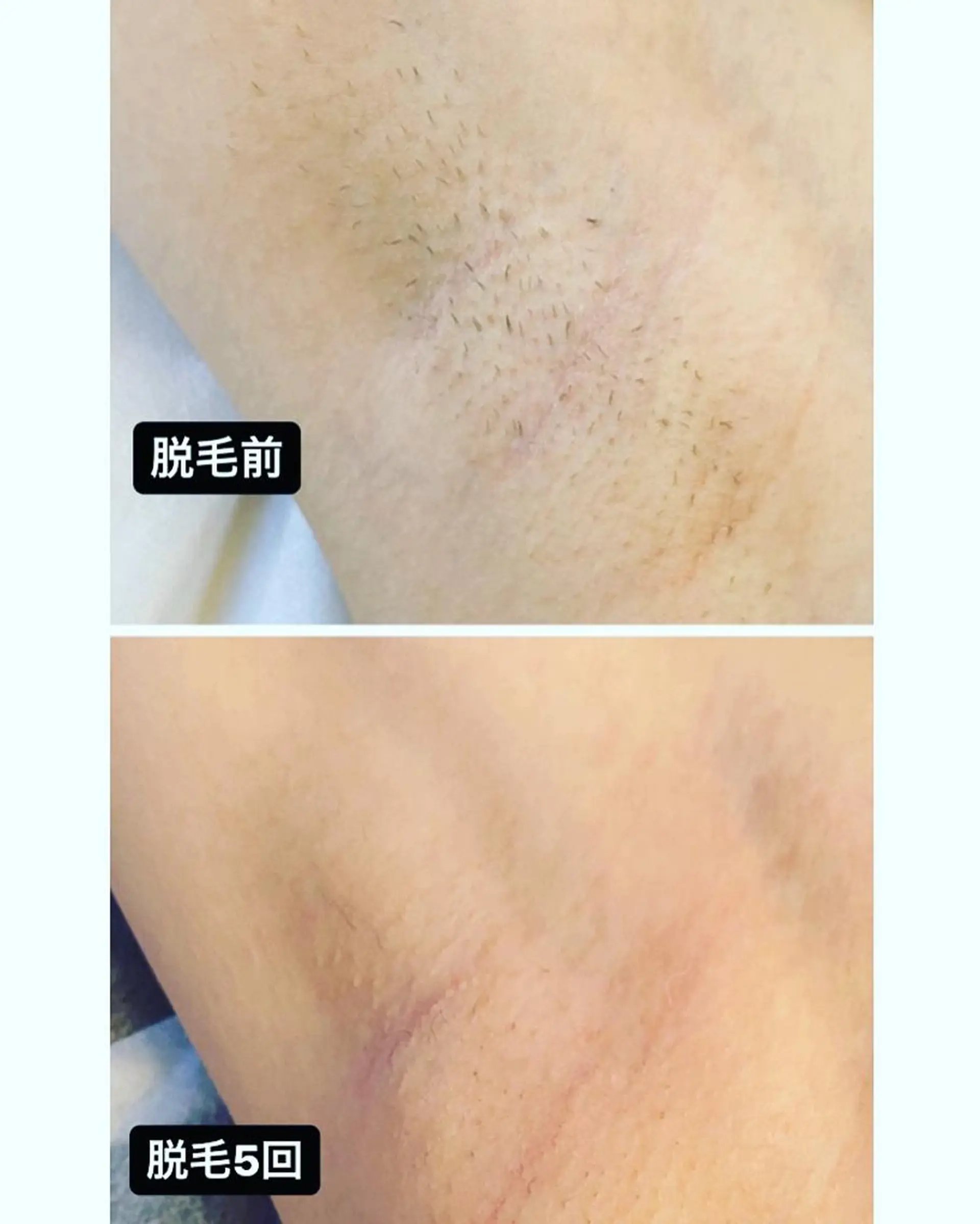 脱毛・エステサロン LuLuNのエステ・リラクイメージ