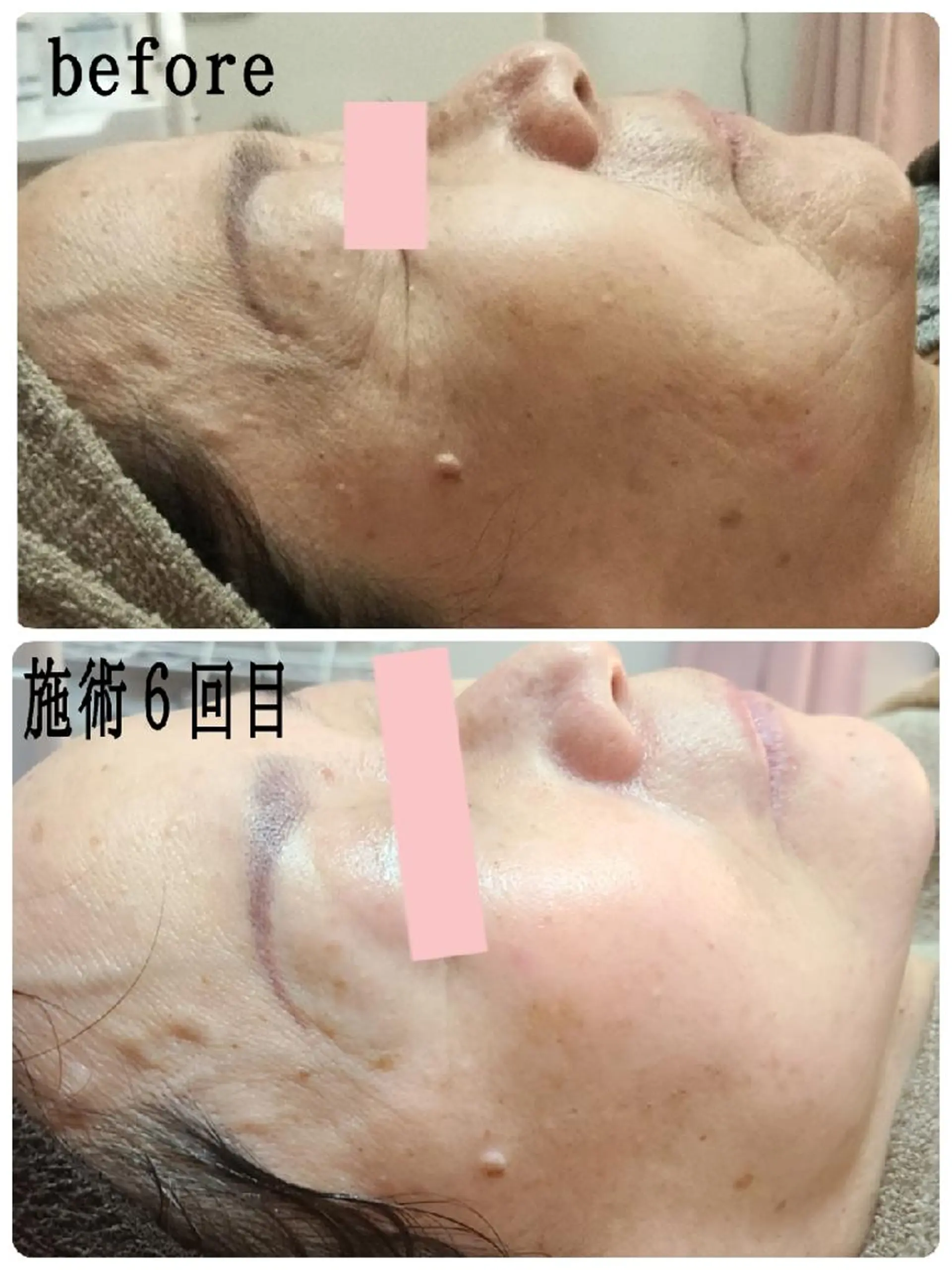 小顔 美肌専門 Matoriaのエステ・リラクイメージ