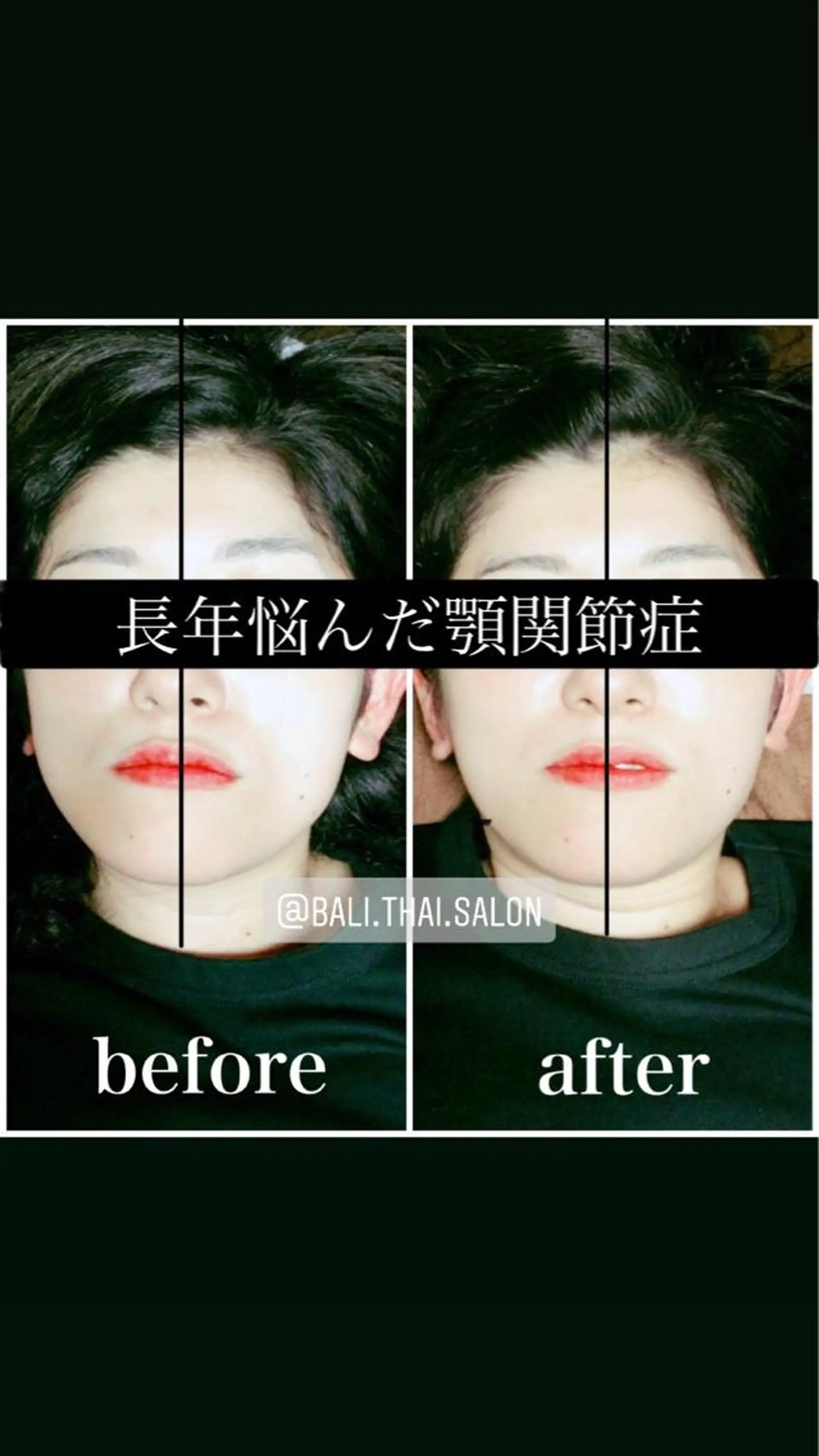 🌈歪み改善🌈 バリンタイ すぎうらのエステ・リラクイメージ