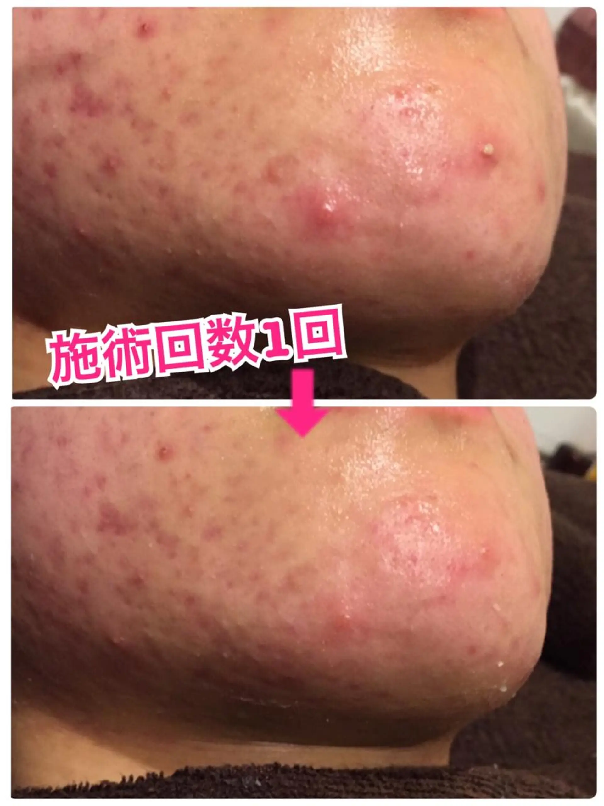 ロング カラー パーマ ヘアアレンジ メンズ キッズ ネイル マツエク・マツパ クリスマス 冬ネイル クリスマス ‍痩身＆ボディ 結果出し🌟丹野のエステ・リラクイメージ