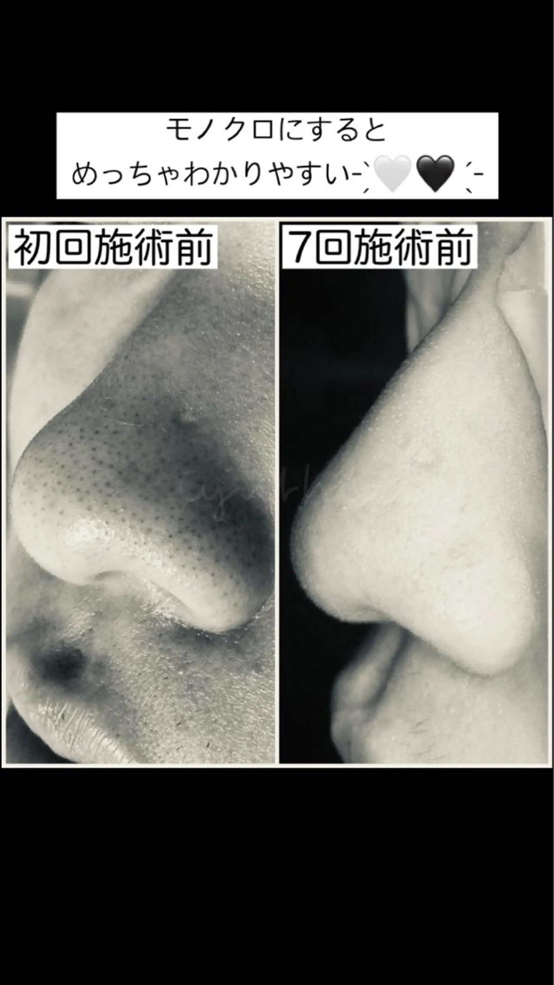 メンズ マツエク・マツパ メンズ韓国風 韓国風マツエク エステ 毛穴ケア専門店 Cynthiaのエステ・リラクイメージ