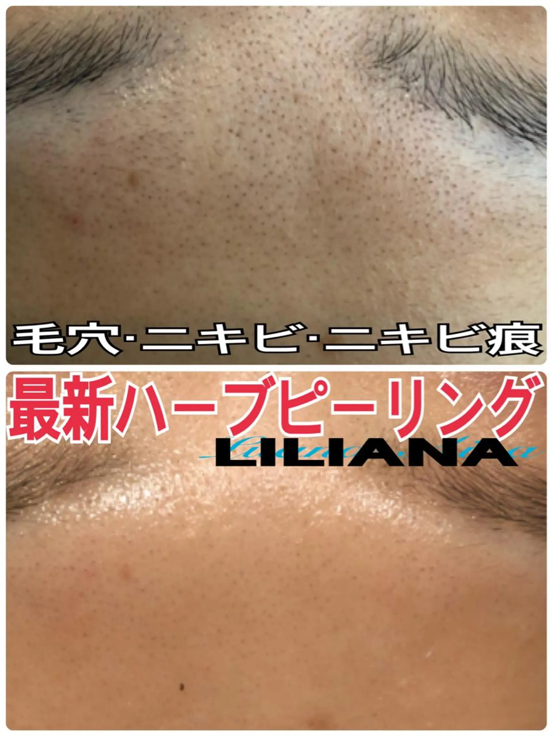 エステ リラク LILIANA ☆YURIのエステ・リラクイメージ