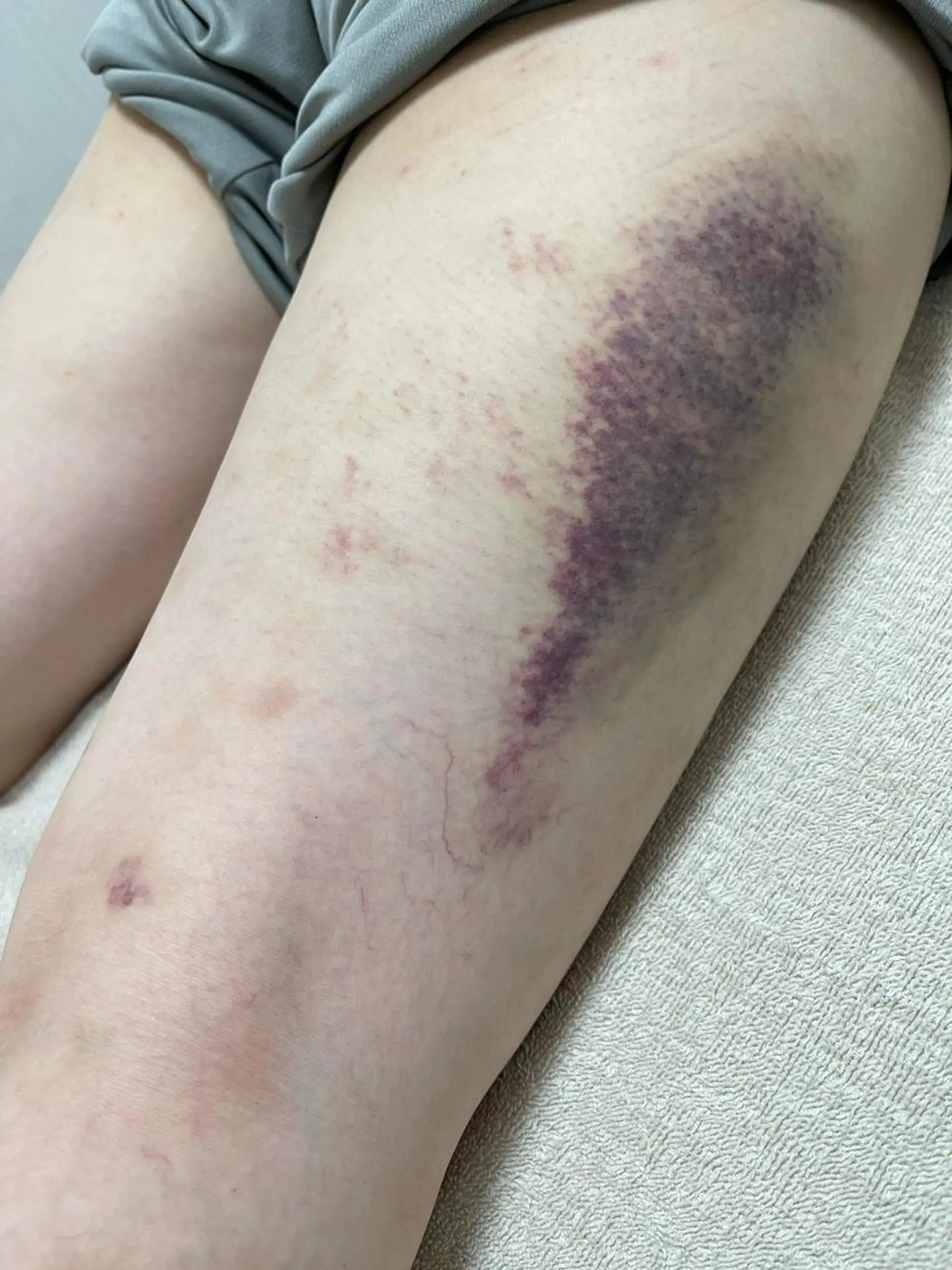 はりすたいる 鍼灸院のエステ・リラクイメージ