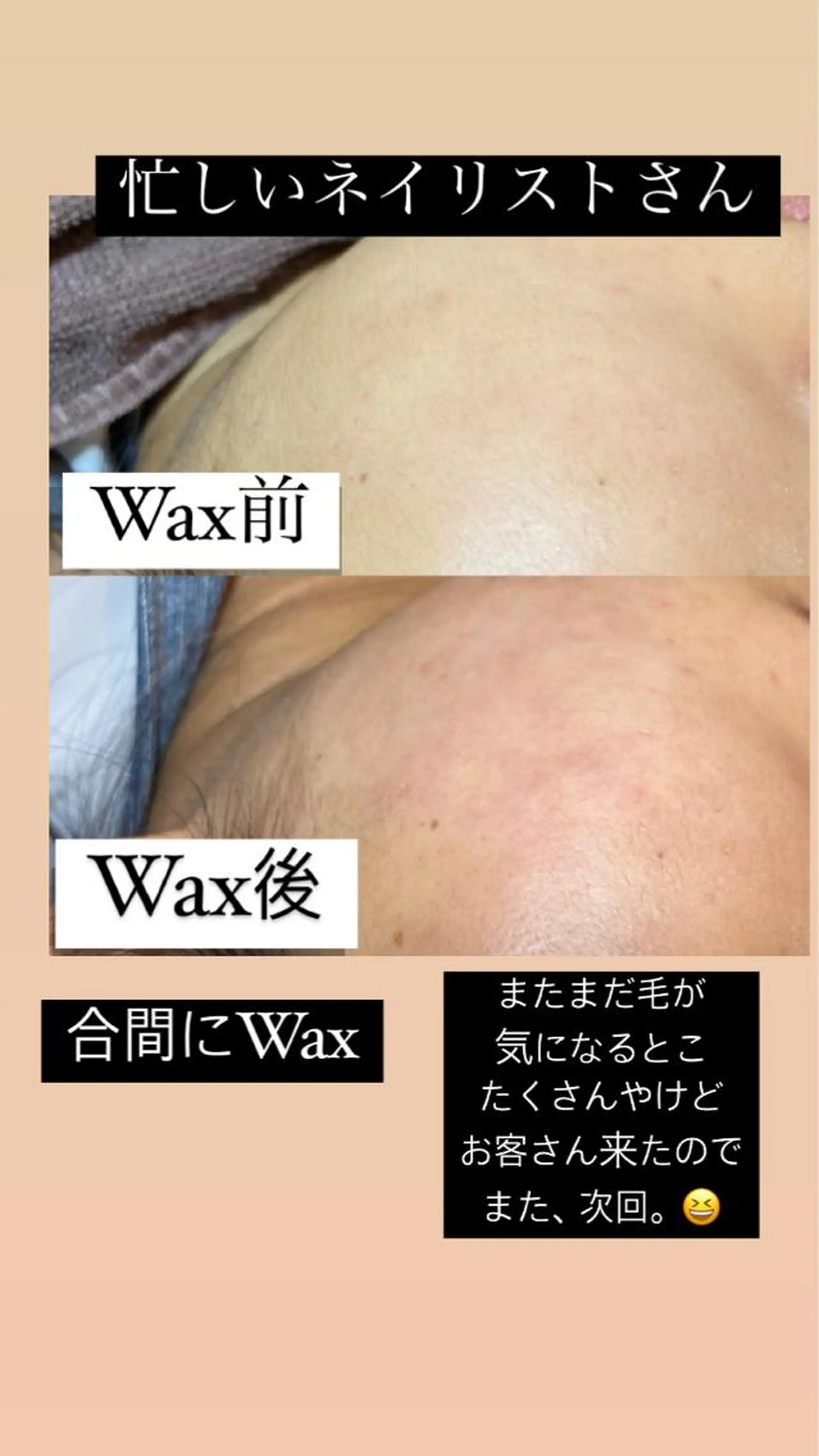 脱毛 産毛専門店 Bittoのエステ・リラクイメージ