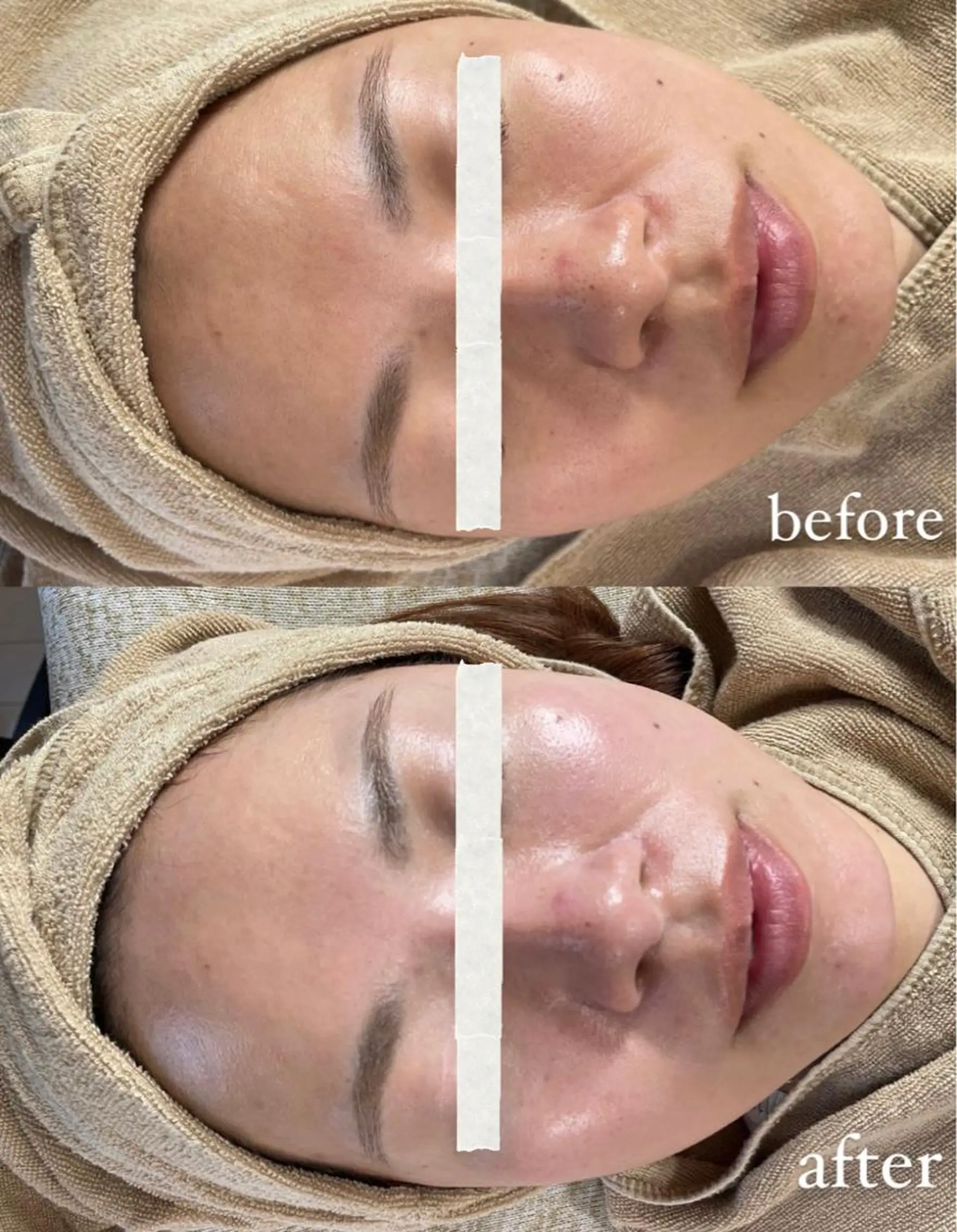 脱毛 エステサロン Mi-mi.iのエステ・リラクイメージ