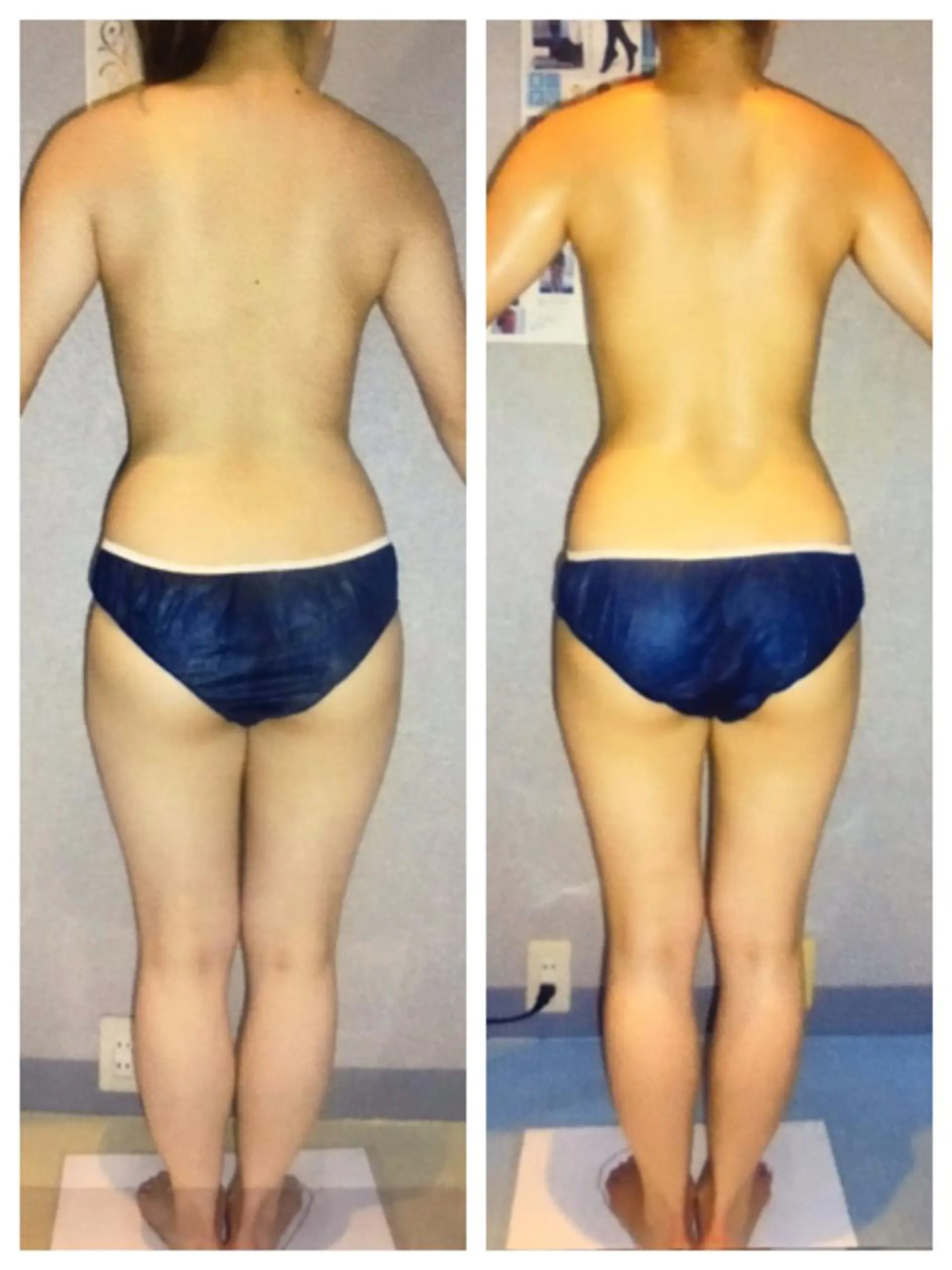 セラピエール 梅田店のエステ・リラクイメージ