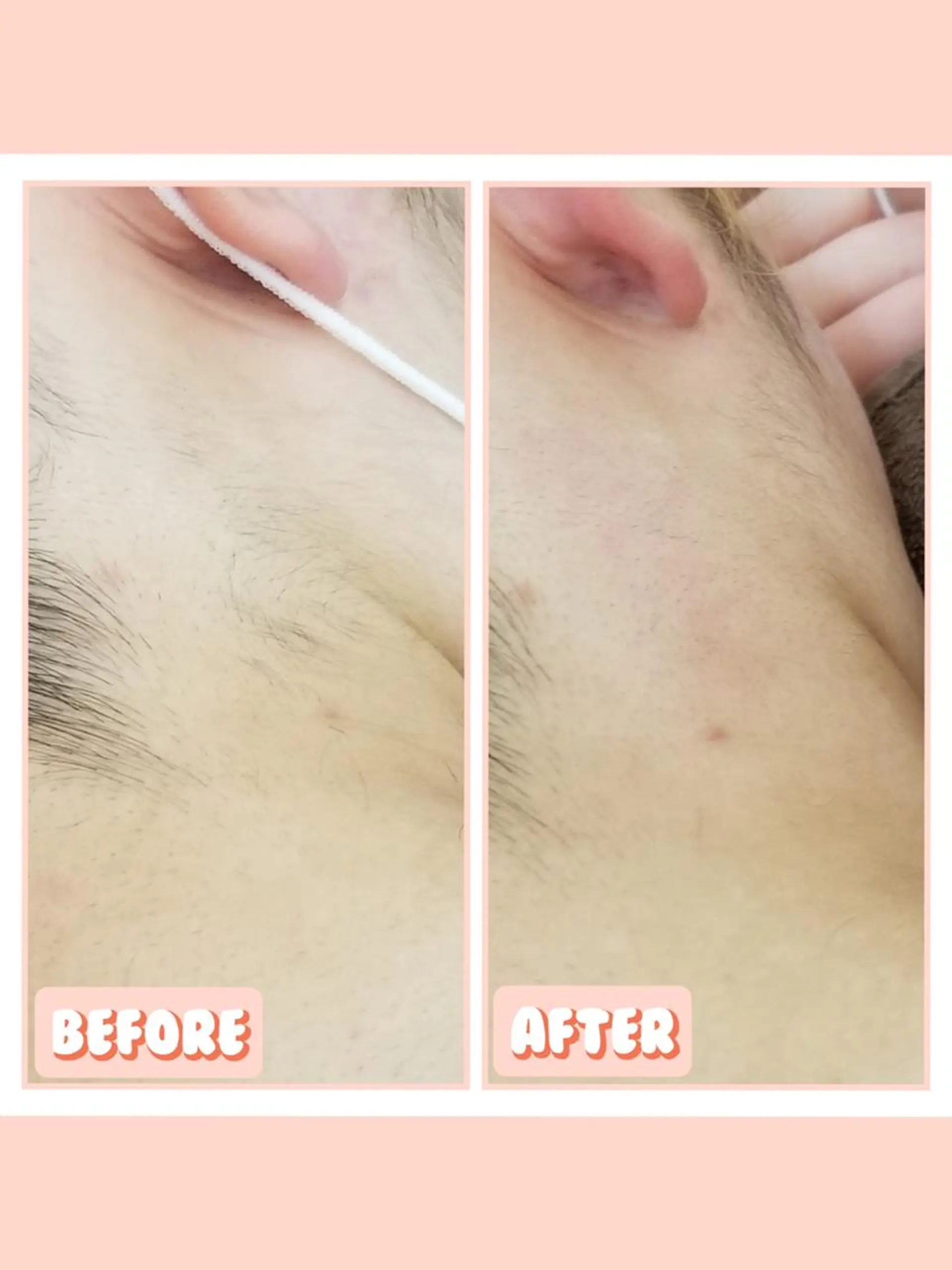 脱毛 salonde ReGodのエステ・リラクイメージ