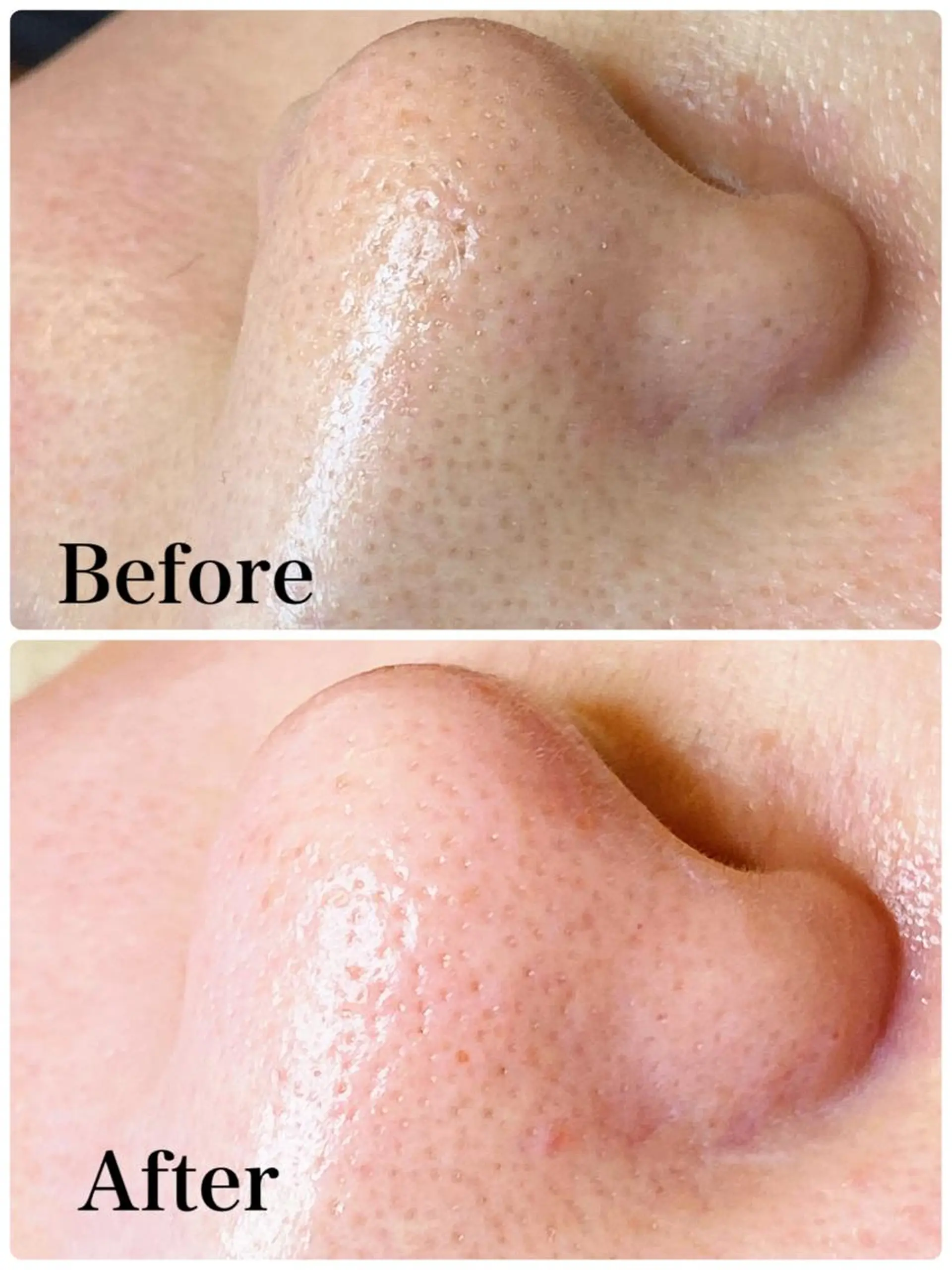 多摩境ViVi chinamiのエステ・リラクイメージ