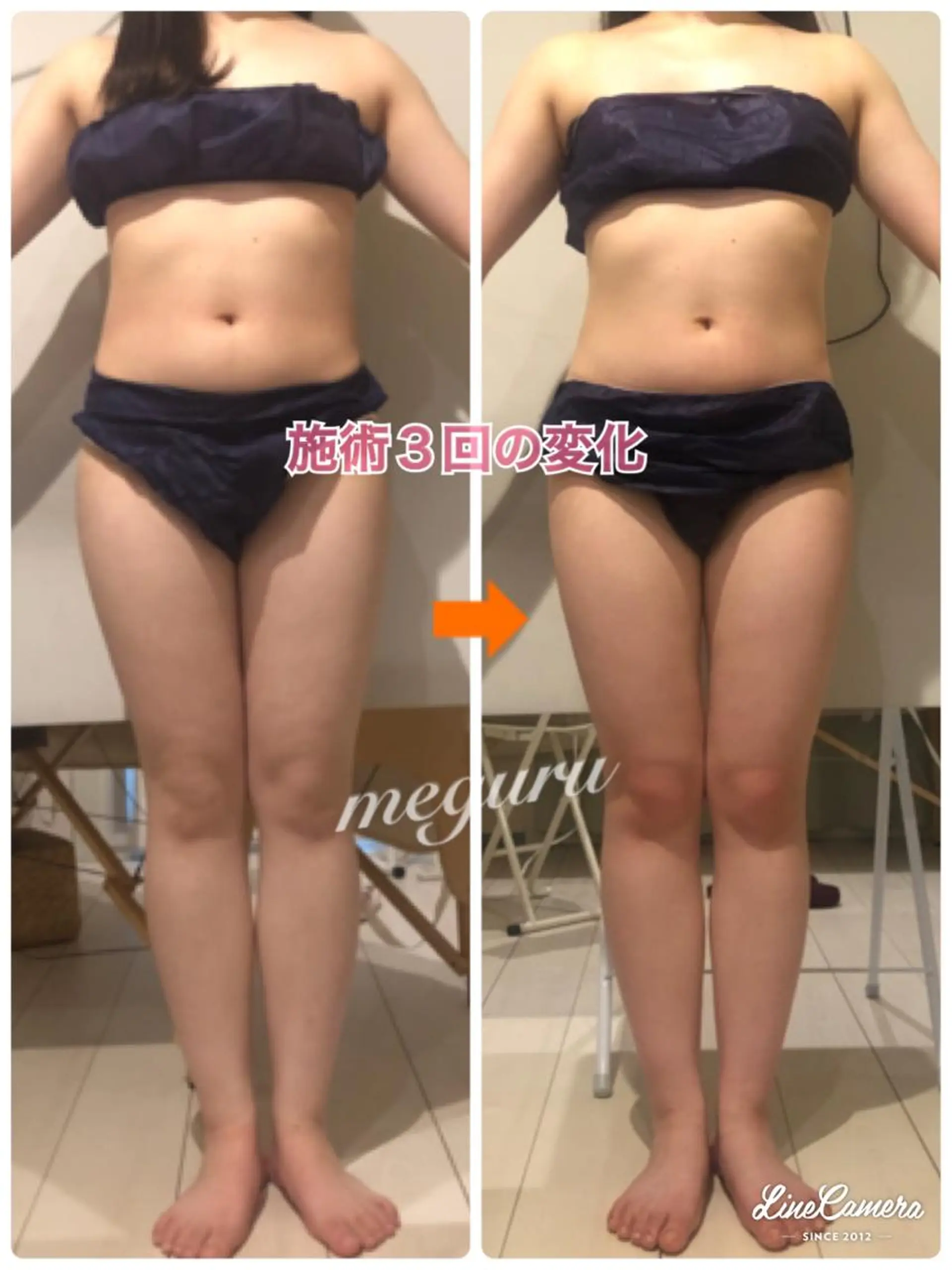 ショート カラー パーマ ヘアアレンジ メンズ キッズ ネイル マツエク・マツパ エステ リラク ‍痩身＆ボディ 結果出し🌟丹野のエステ・リラクイメージ