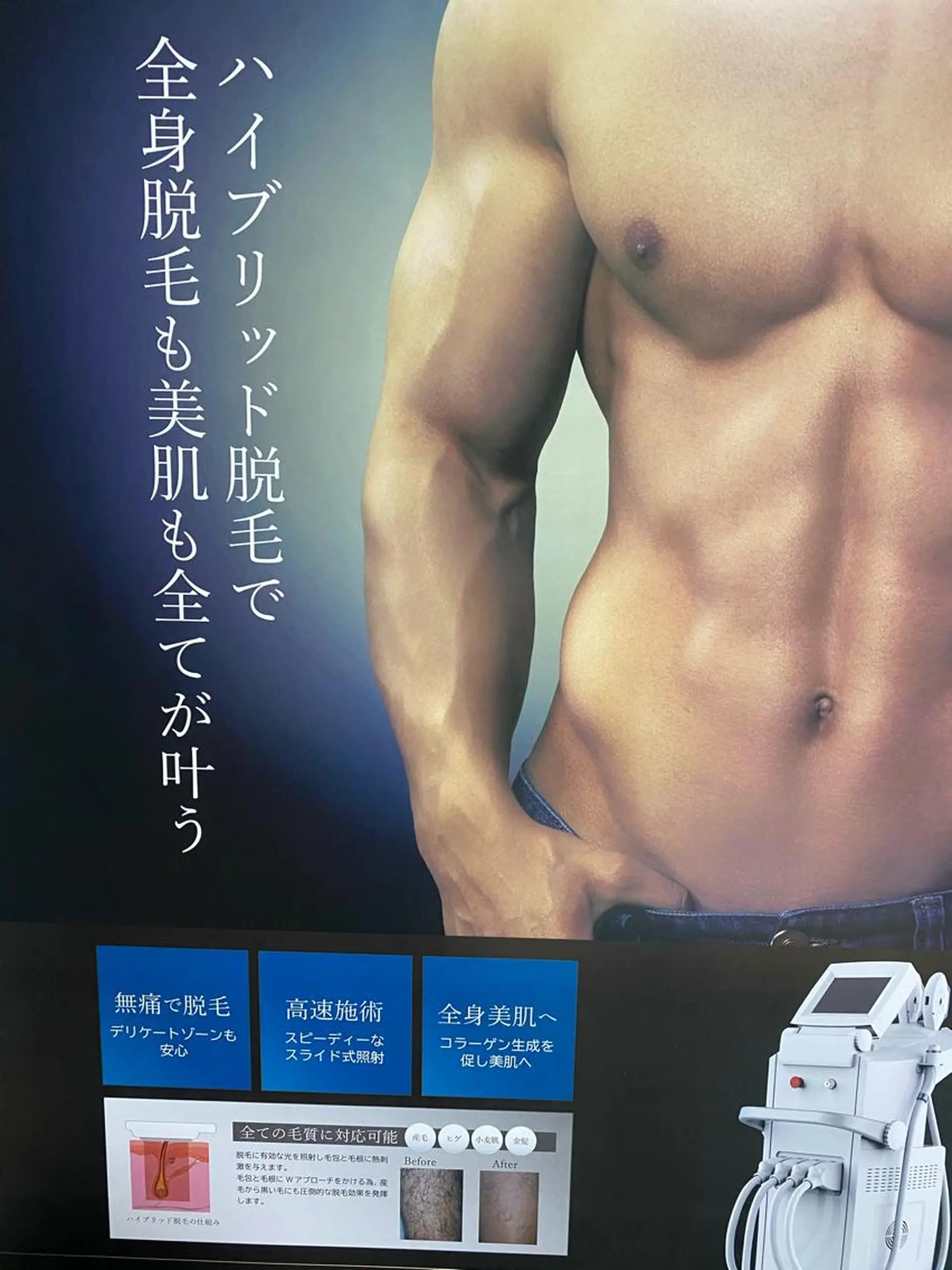 脱毛 HIKARU chieのエステ・リラクイメージ